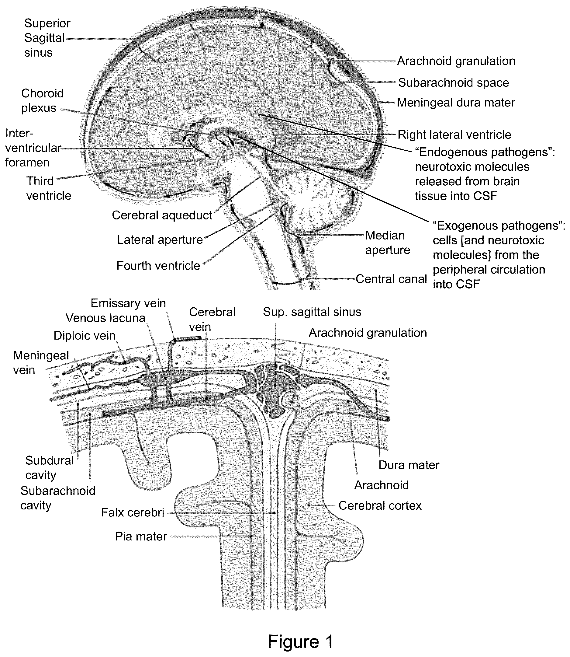 Patent US12616822 Figure 1 – Cerebrospinal fluid purification system
