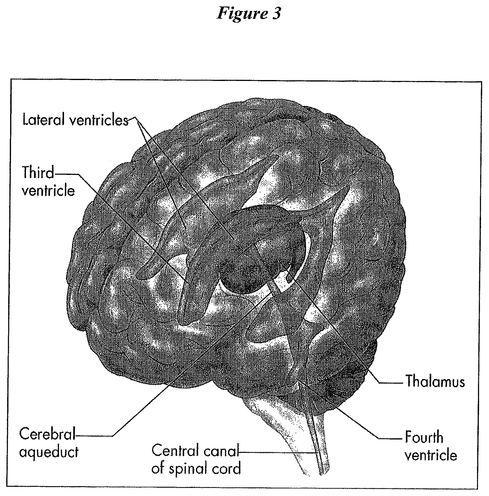 Patent US12616822 Figure 3 – Cerebrospinal fluid purification system
