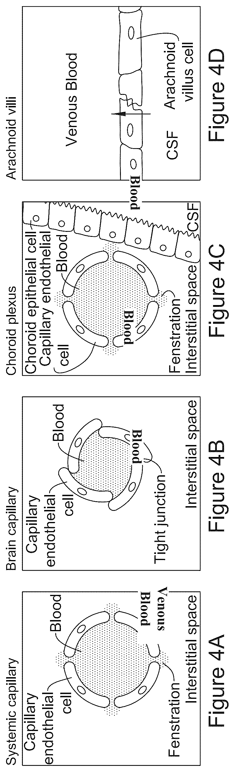 Patent US12616822 Figure 4 – Cerebrospinal fluid purification system