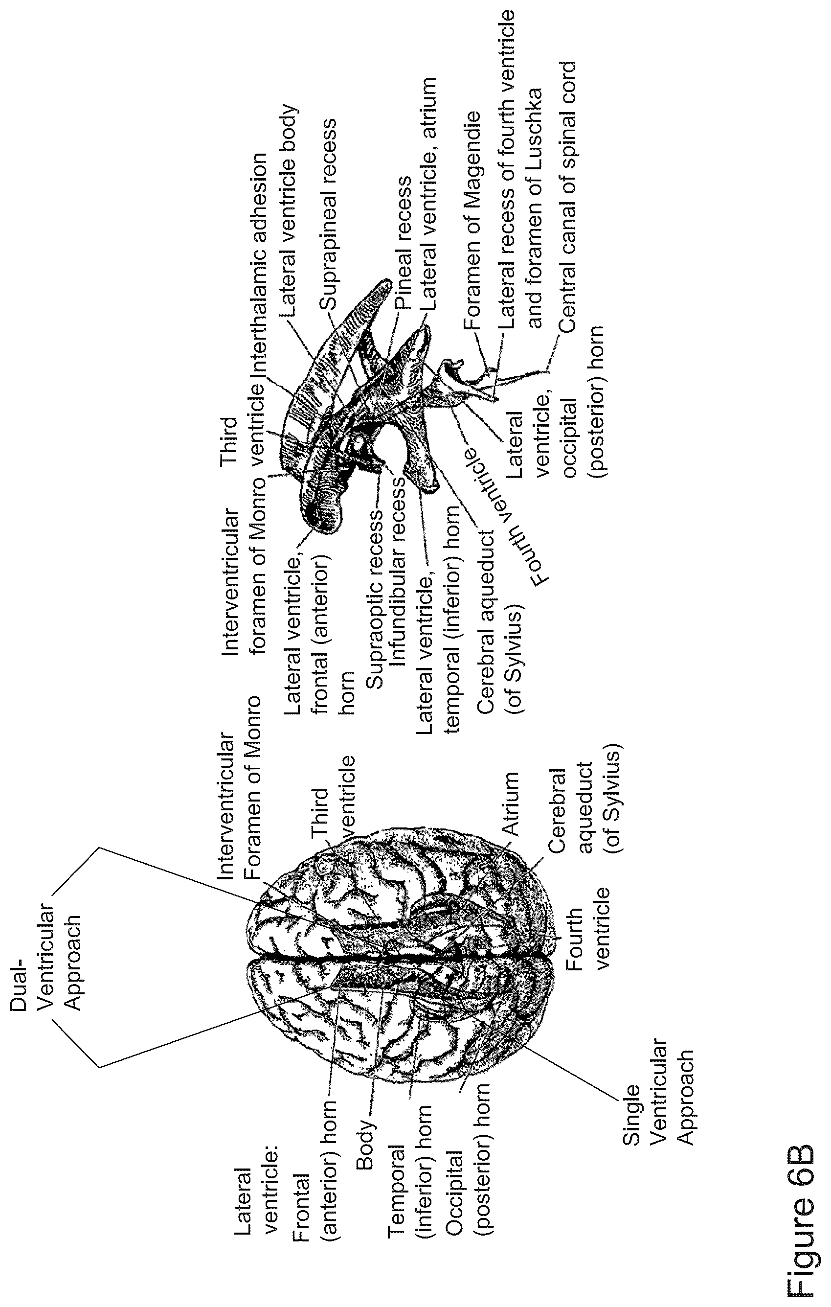 Patent US12616822 Figure 7 – Cerebrospinal fluid purification system