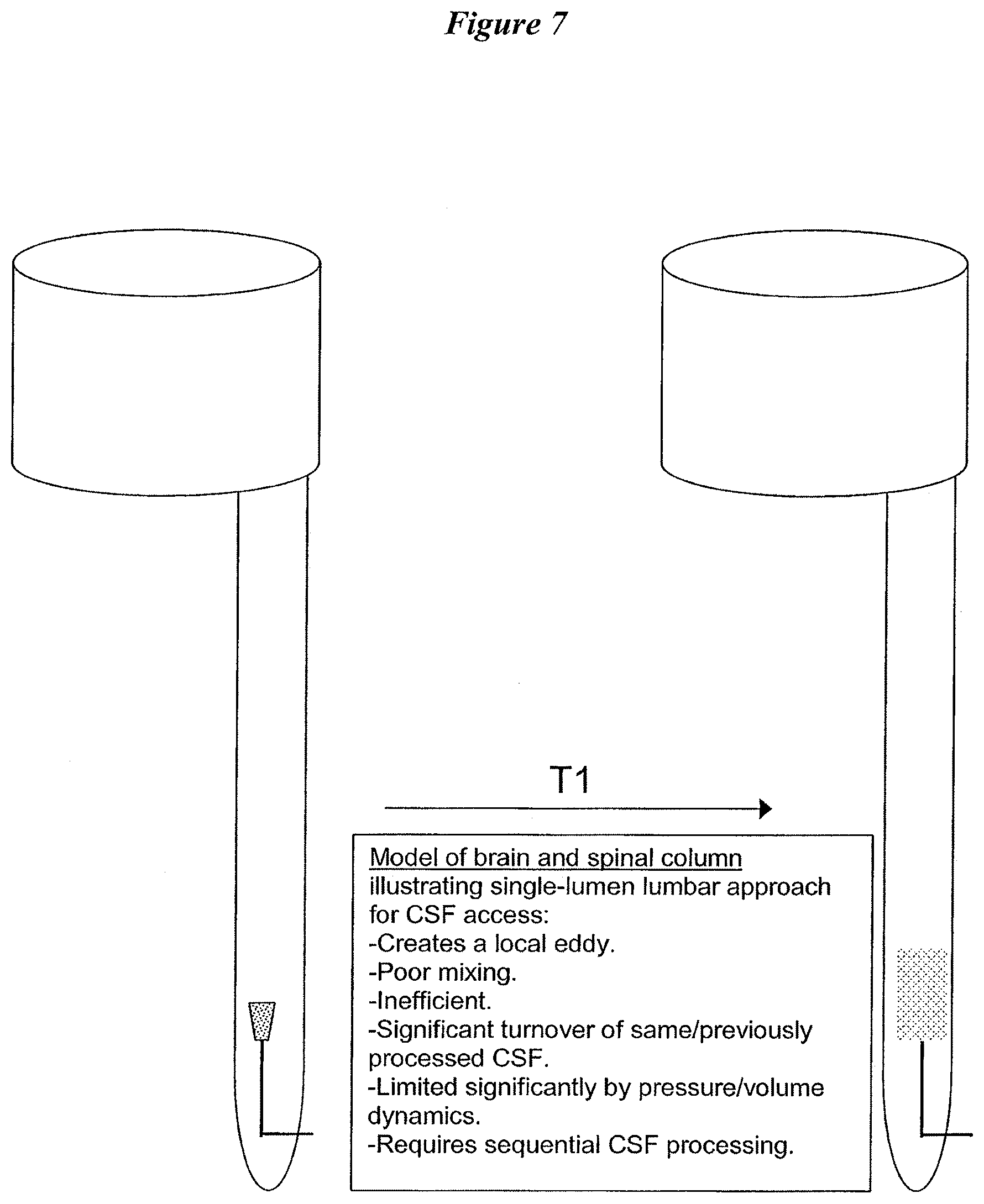 Patent US12616822 Figure 9 – Cerebrospinal fluid purification system