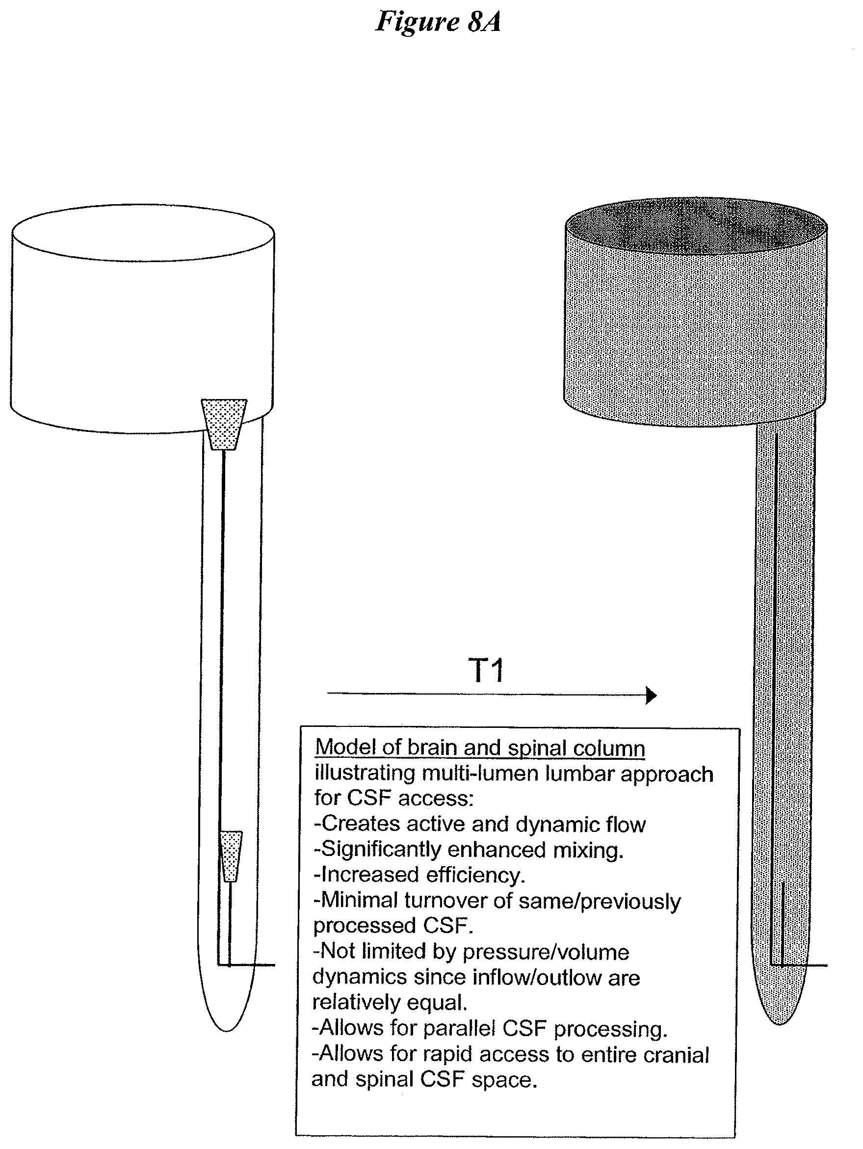 Patent US12616822 Figure 10 – Cerebrospinal fluid purification system