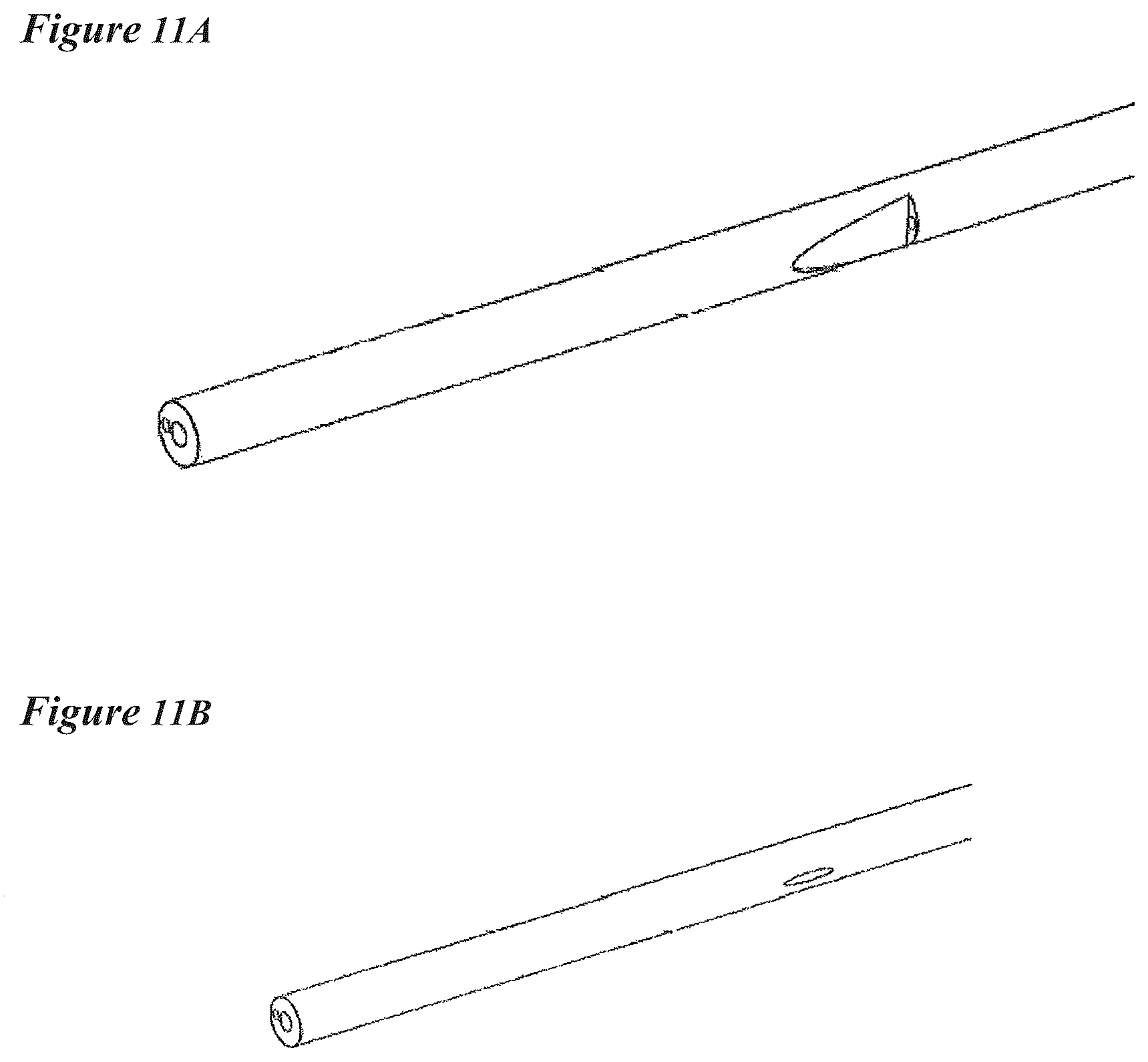 Patent US12616822 Figure 14 – Cerebrospinal fluid purification system