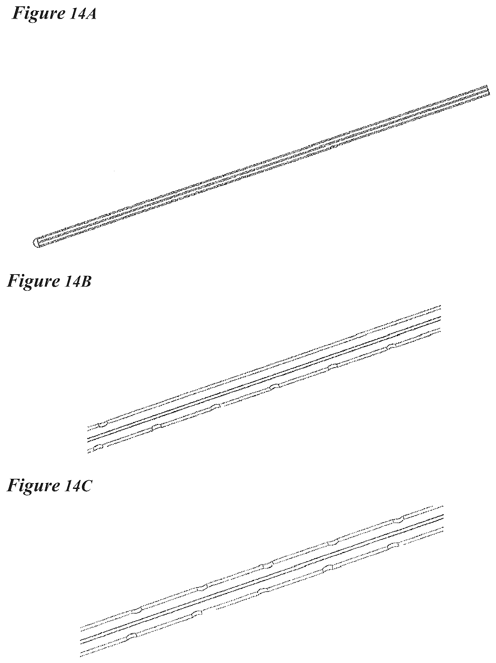 Patent US12616822 Figure 17 – Cerebrospinal fluid purification system