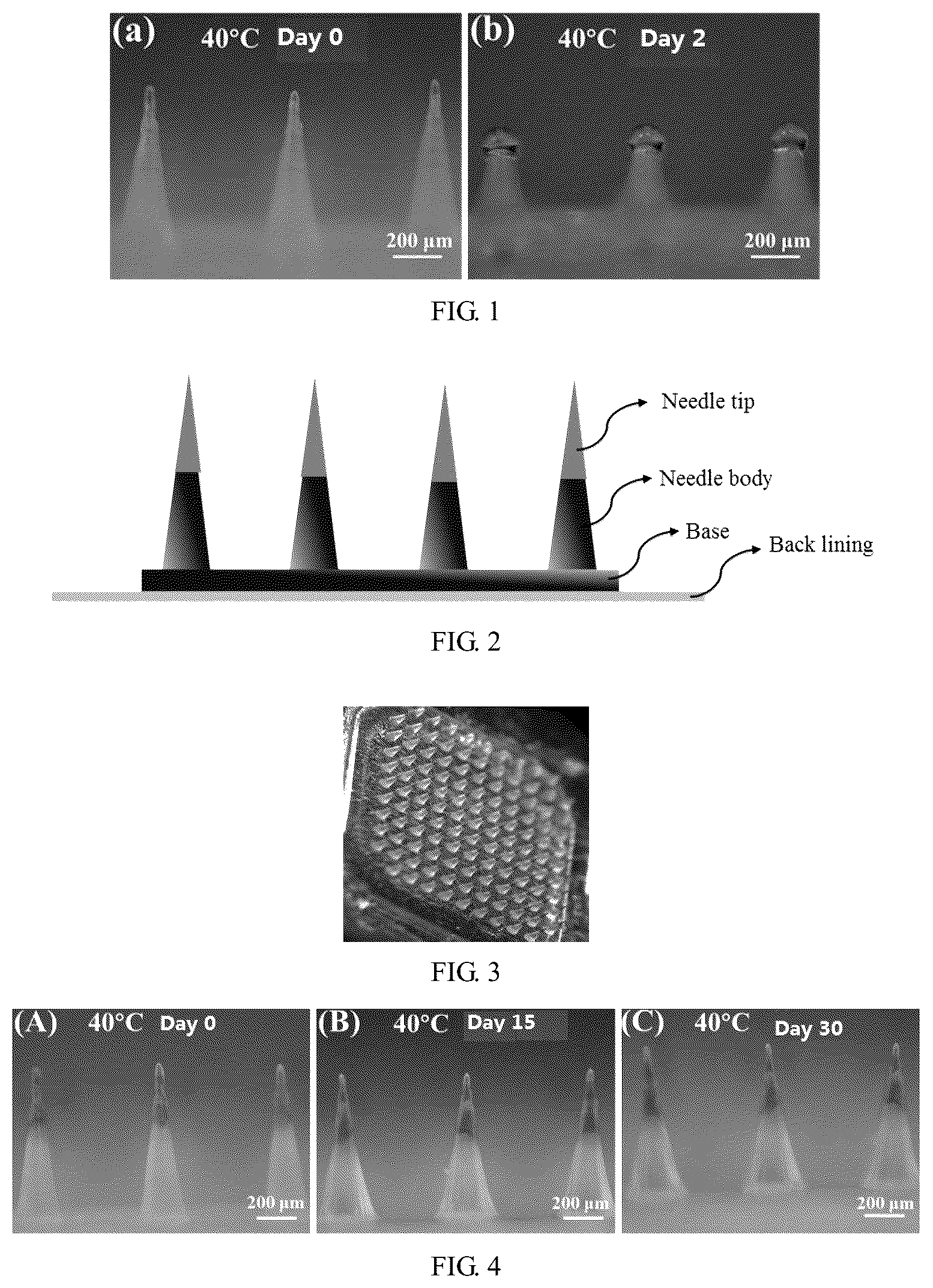 Patent US12616824 Figure 1 – Heat-resistant implantable polymer microneedle and preparation method therefor and application thereof