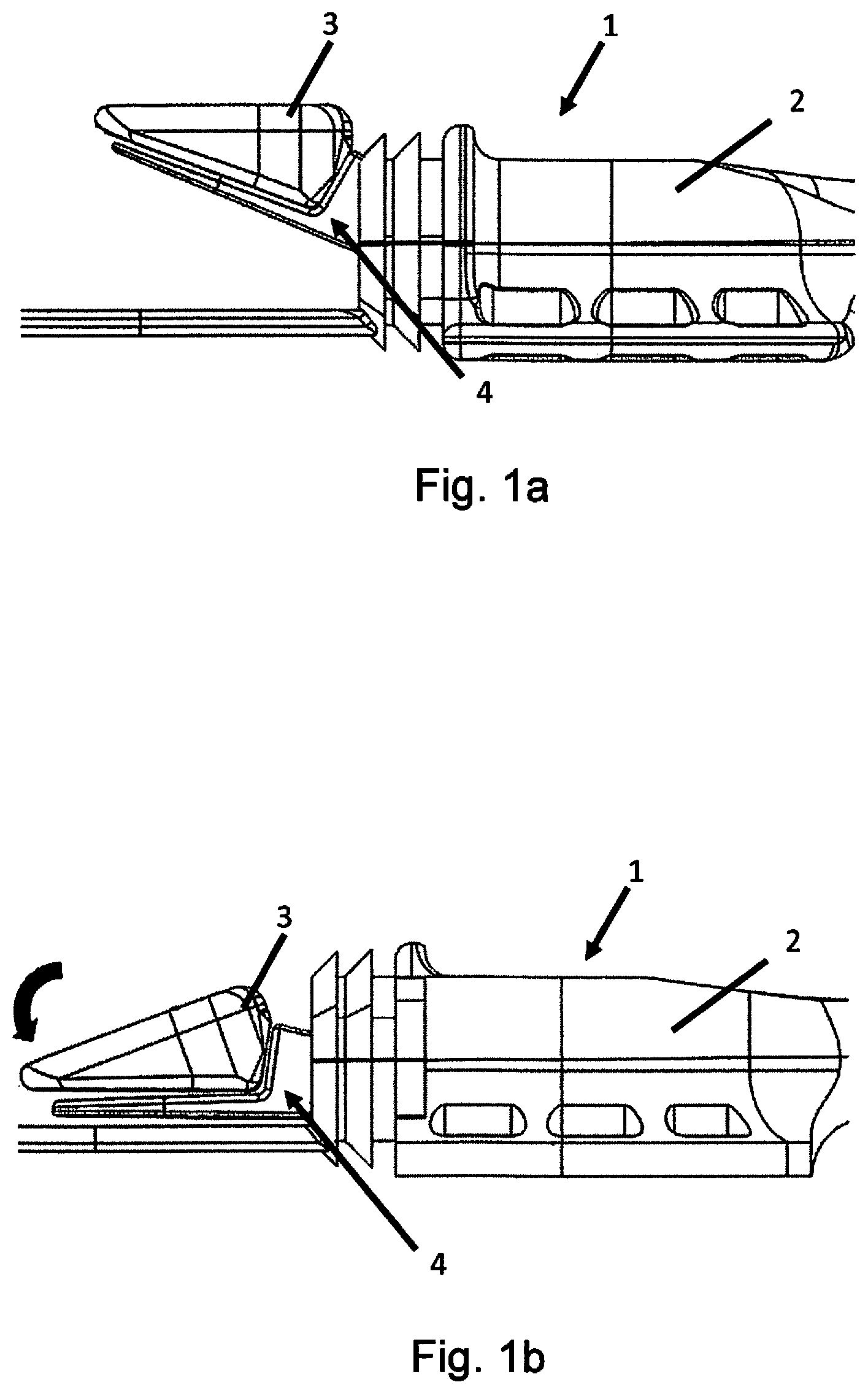 Patent US12616825 Figure 1 – Implantable access device for accessing the vascular system of a human or animal body, particularly subcutaneously implantable access port