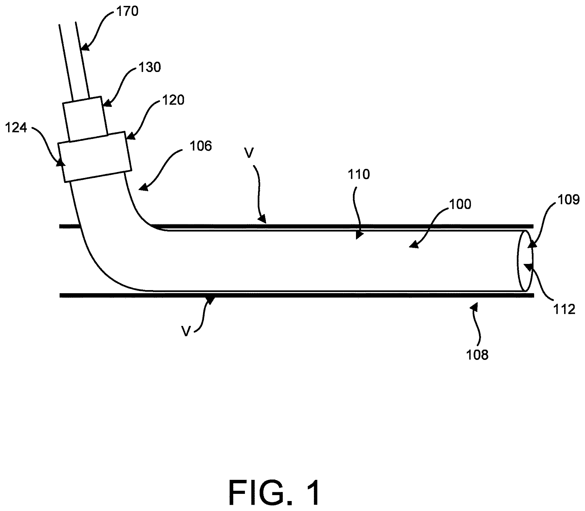 Patent US12616826 Figure 1 – Push-pull tightening port for percutaneous circulatory support device repositioning and axial locking, and attachment to sheath hub