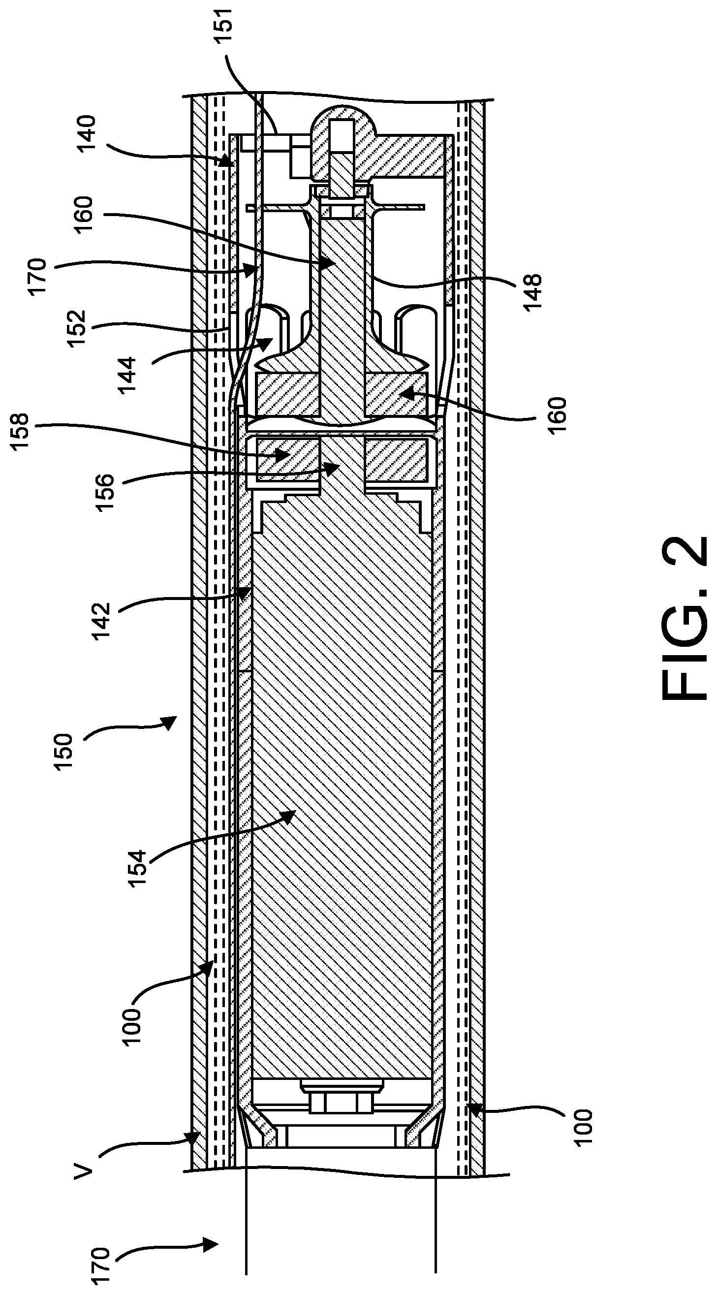 Patent US12616826 Figure 2 – Push-pull tightening port for percutaneous circulatory support device repositioning and axial locking, and attachment to sheath hub
