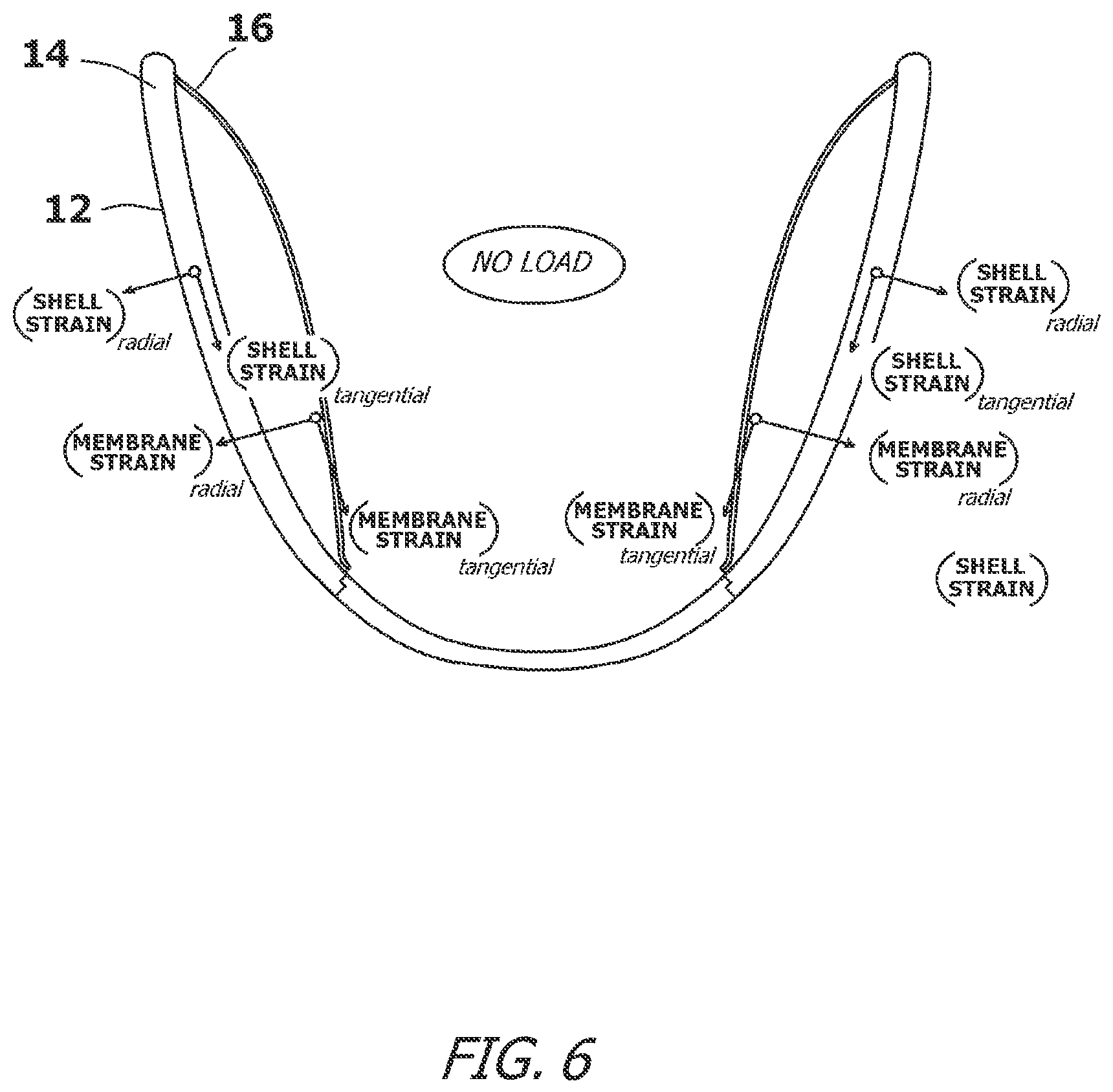 Patent US12616827 Figure 6 – System and method for assisting the heart in pumping blood