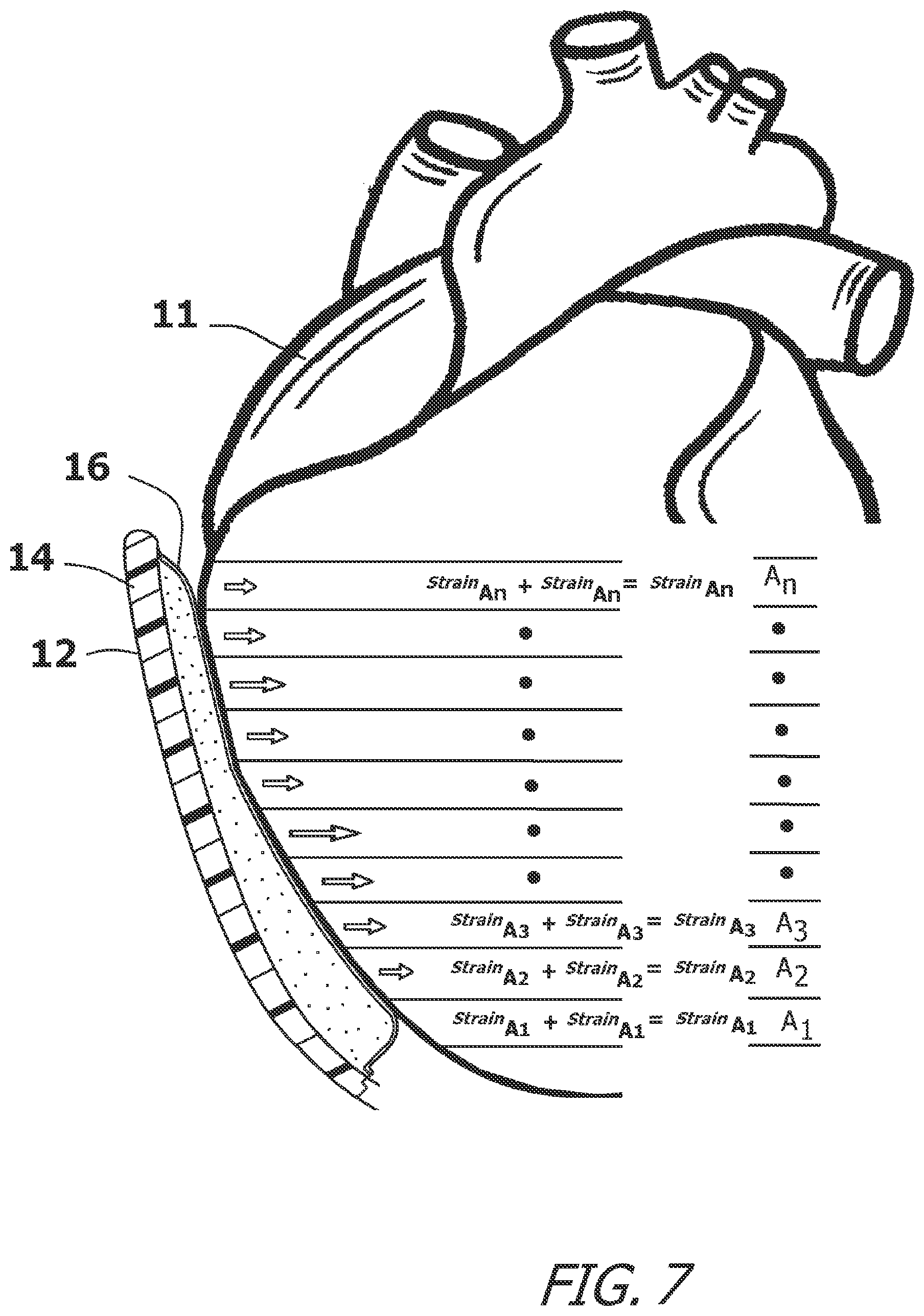 Patent US12616827 Figure 7 – System and method for assisting the heart in pumping blood