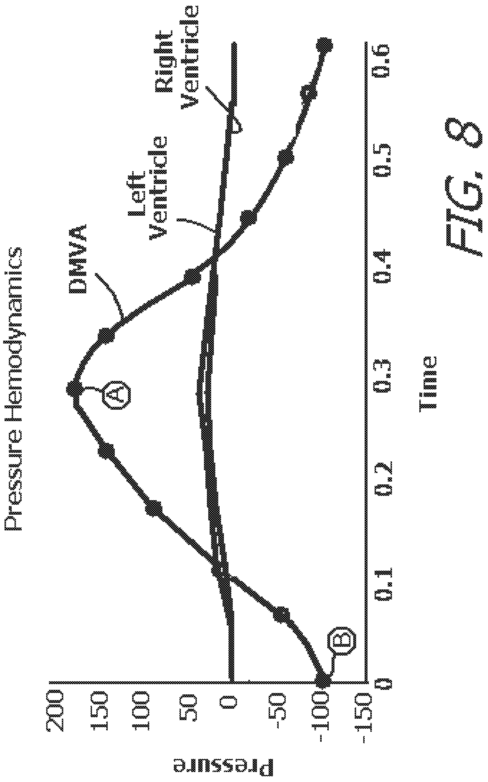 Patent US12616827 Figure 8 – System and method for assisting the heart in pumping blood