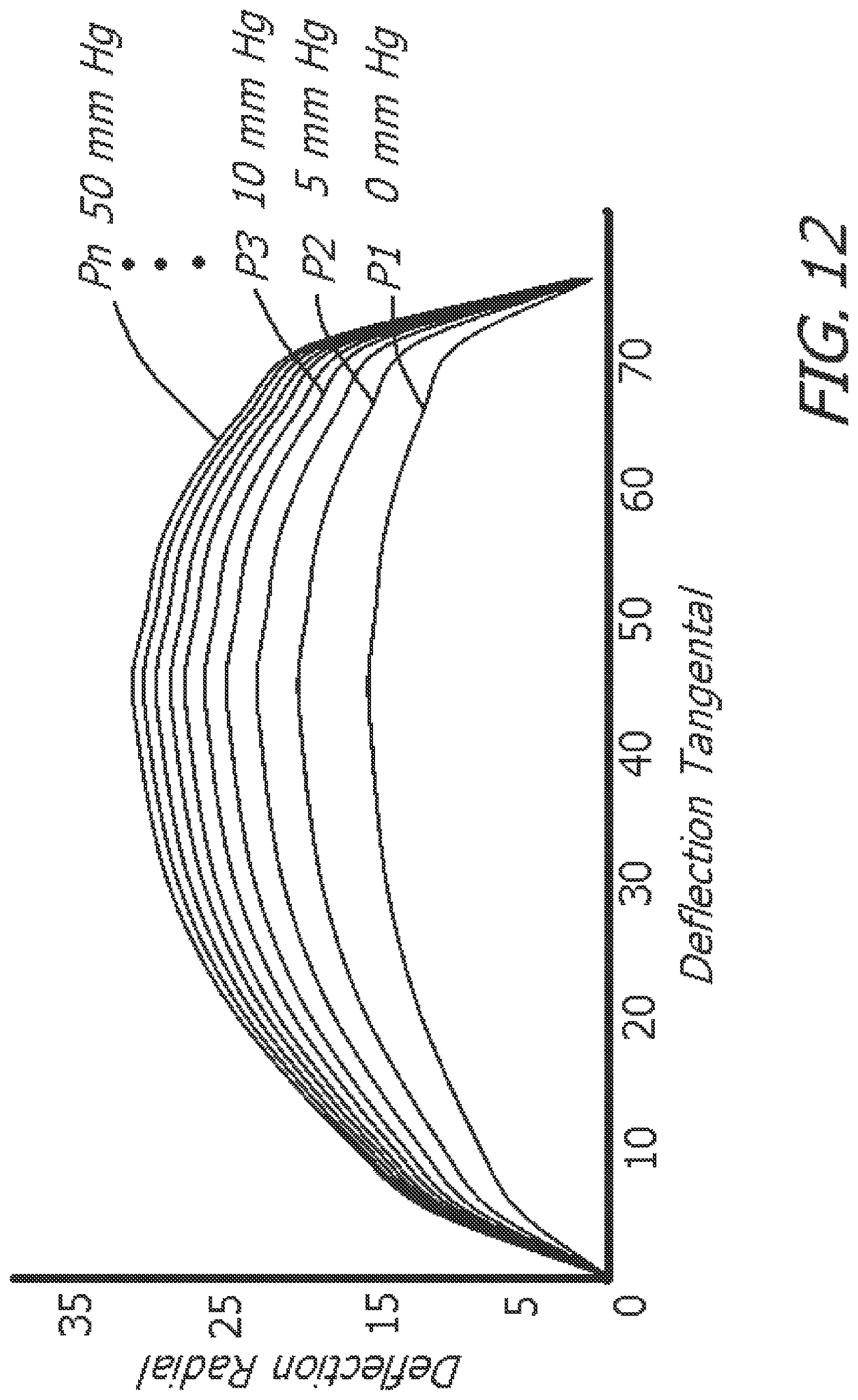 Patent US12616827 Figure 12 – System and method for assisting the heart in pumping blood