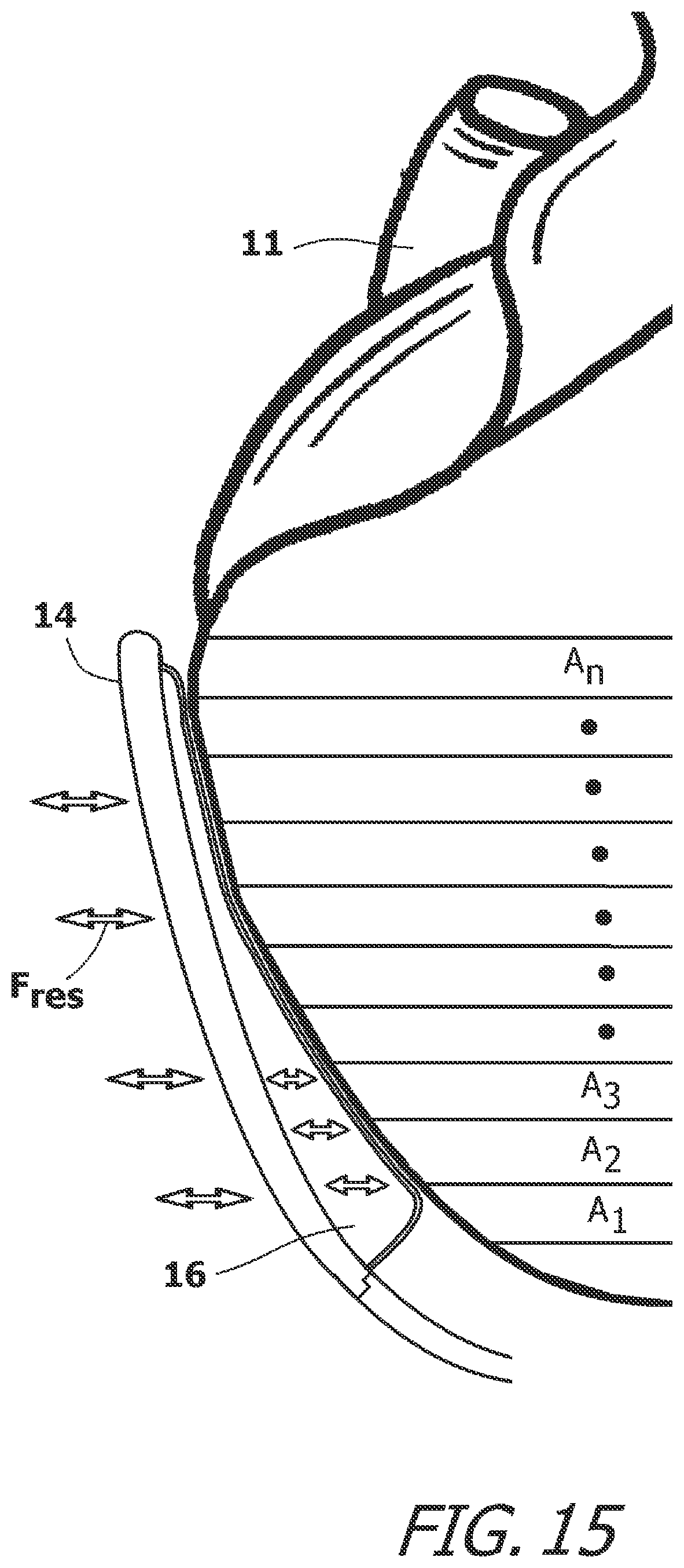 Patent US12616827 Figure 15 – System and method for assisting the heart in pumping blood