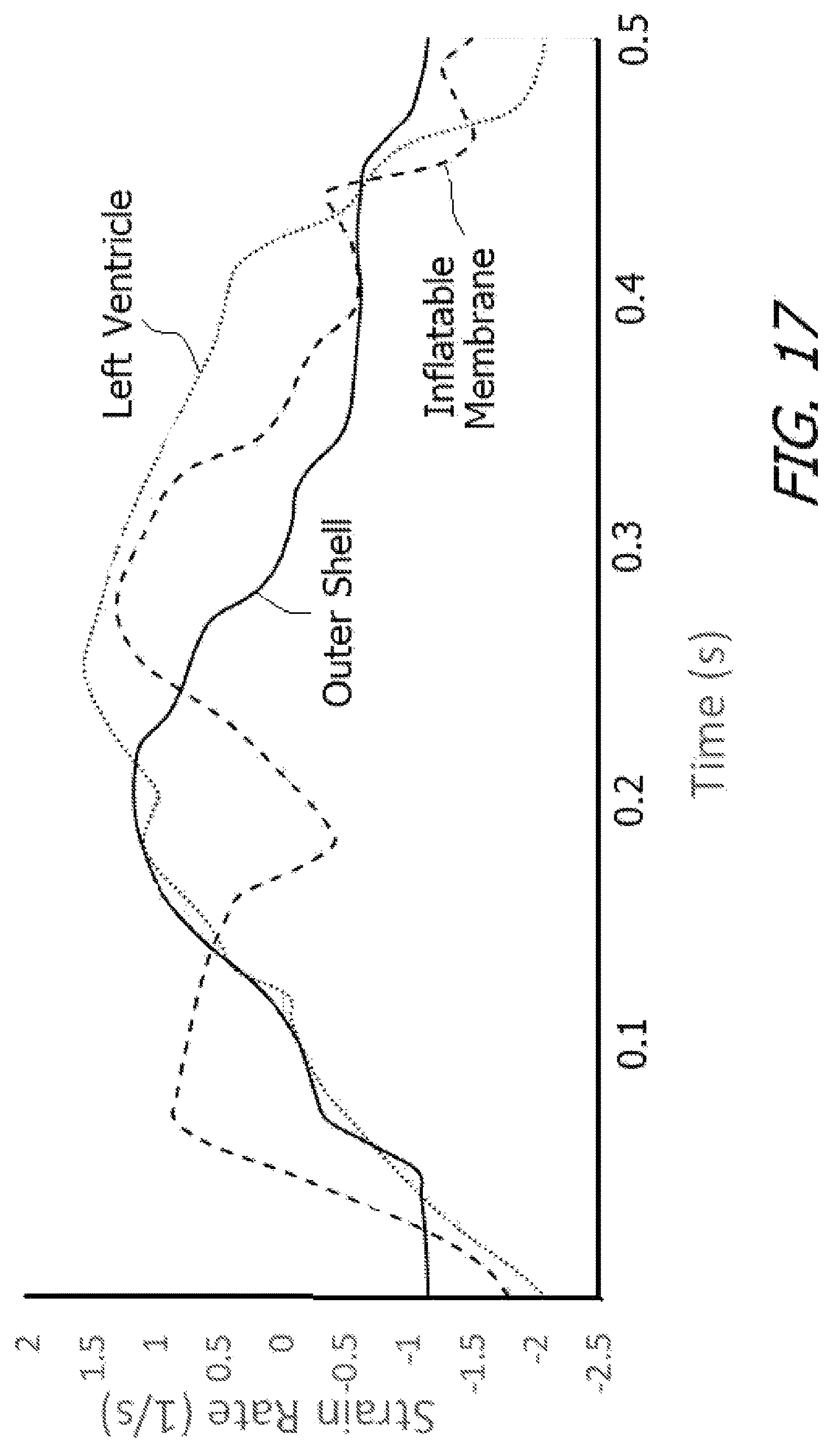 Patent US12616827 Figure 17 – System and method for assisting the heart in pumping blood
