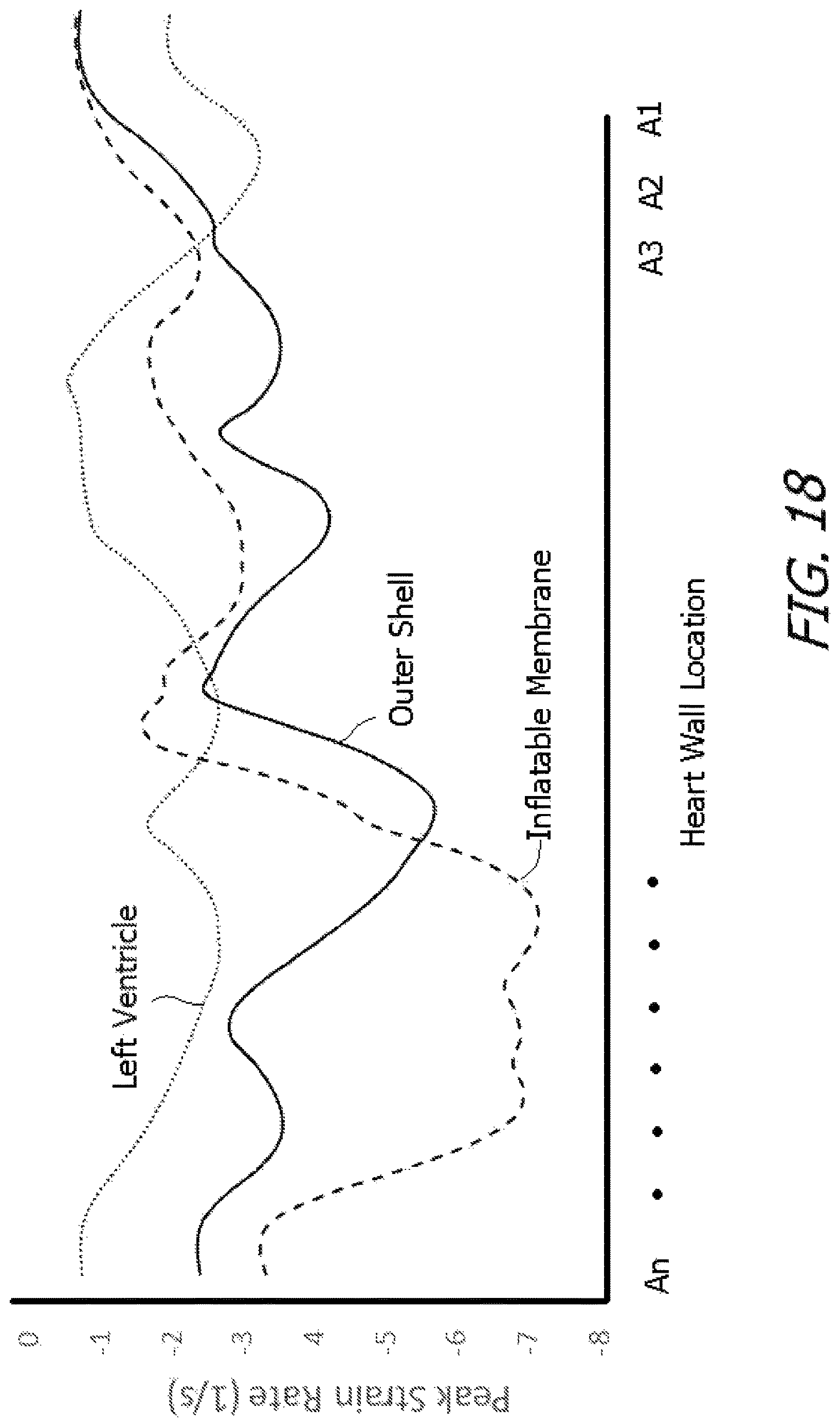 Patent US12616827 Figure 18 – System and method for assisting the heart in pumping blood