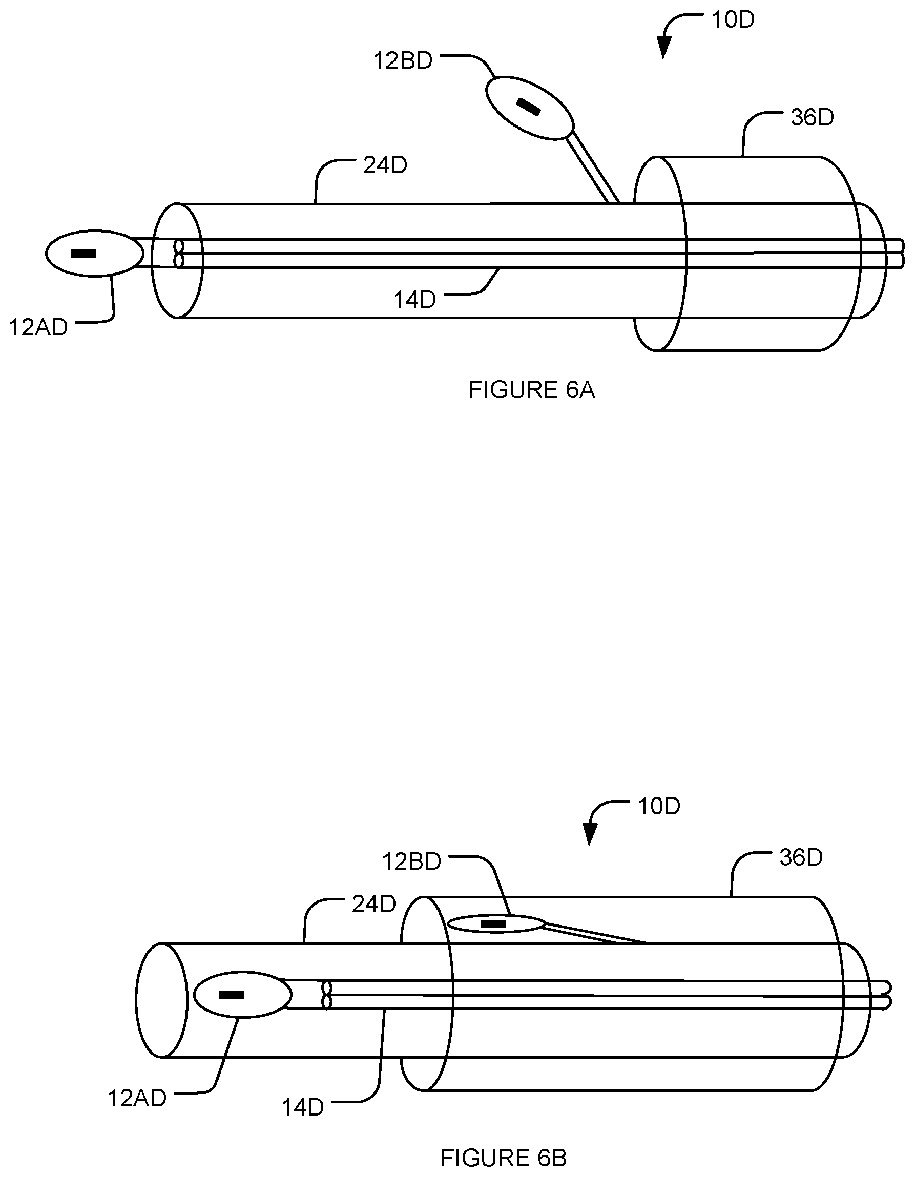Patent US12616831 Figure 6 – Transvascular nerve stimulation apparatus and methods
