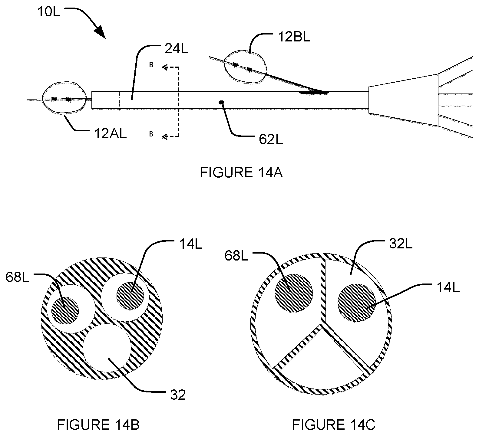 Patent US12616831 Figure 15 – Transvascular nerve stimulation apparatus and methods