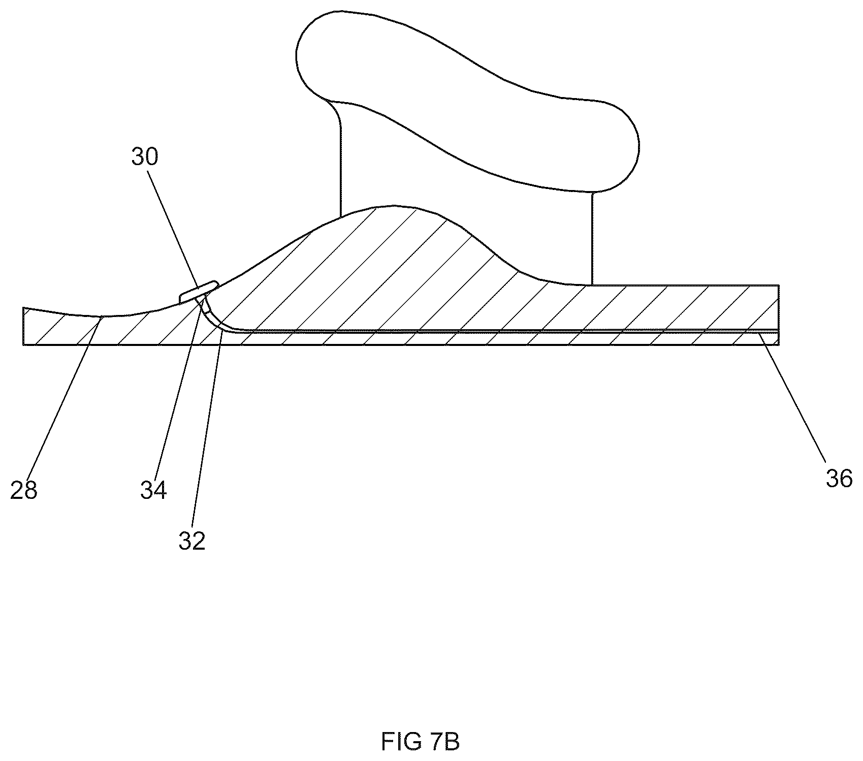 Patent US12616832 Figure 14 – Systems and methods for delivering neuroregenerative therapy