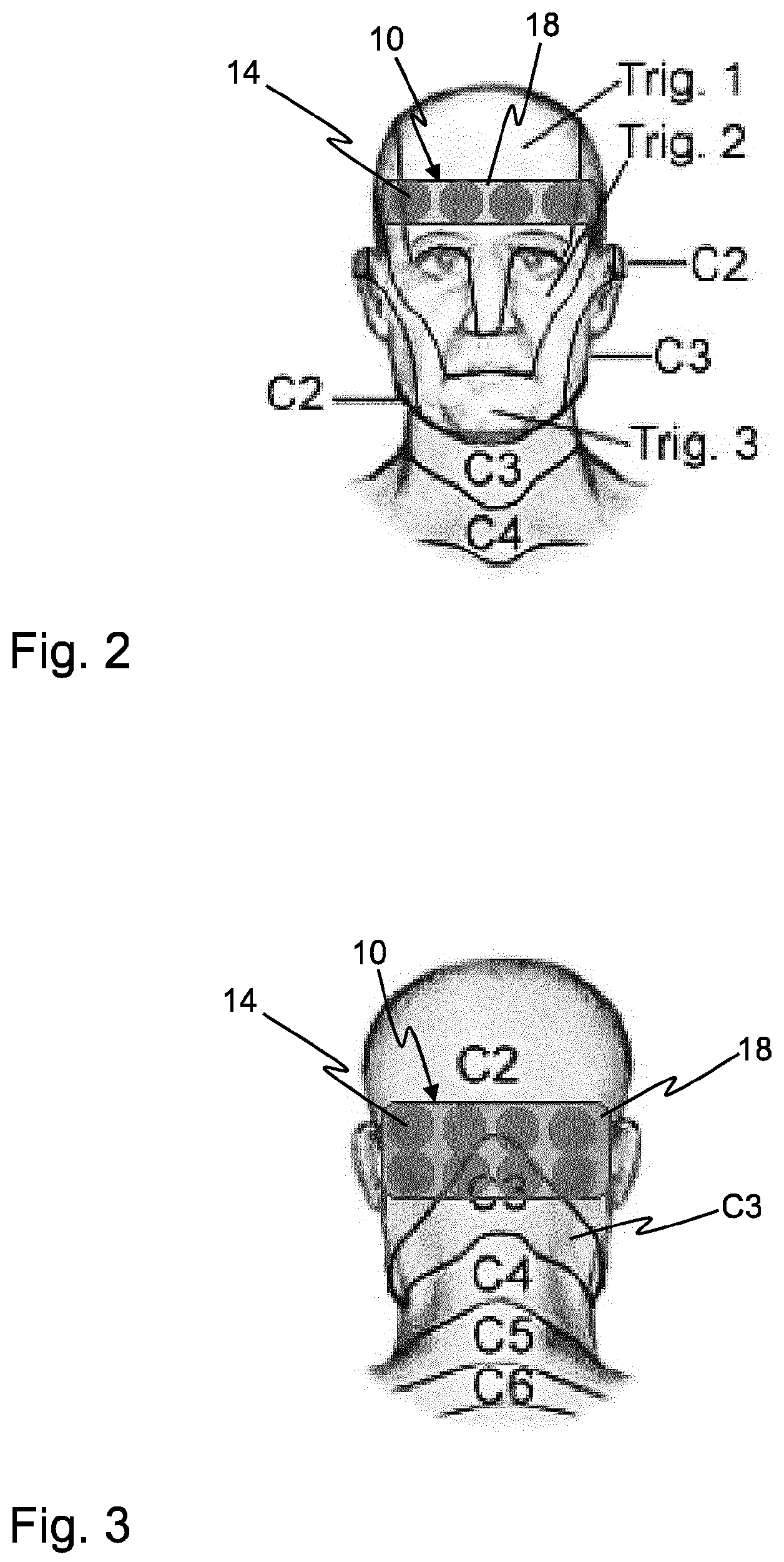 Patent US12616833 Figure 2 – Medical treatment device and method for stimulating neurons of a patent to suppress a pathologically synchronous activity thereof