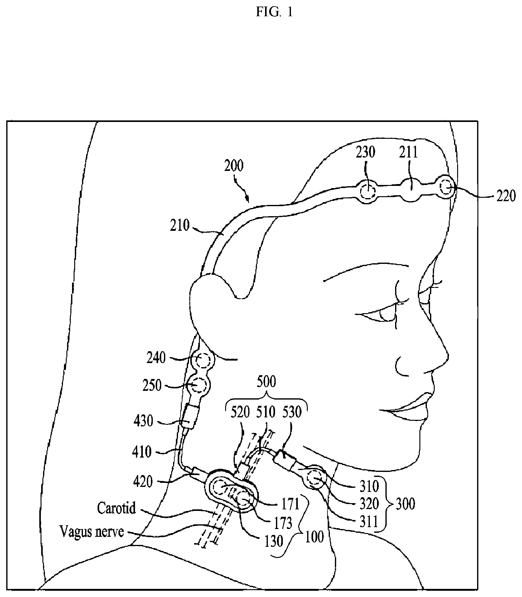 Patent US12616835 Figure 1 – Neurostimulation-based neurofeedback device using brain waves and heartbeat signals