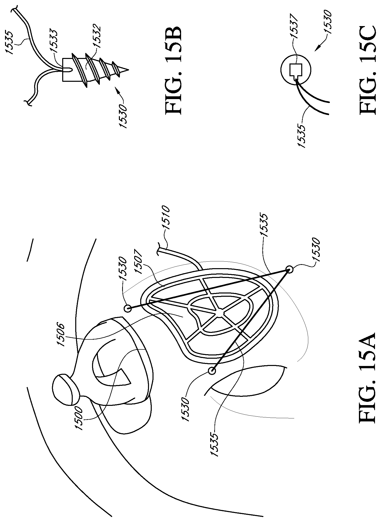 Patent US12616837 Figure 15 – Methods and apparatuses for extracochlear stimulation