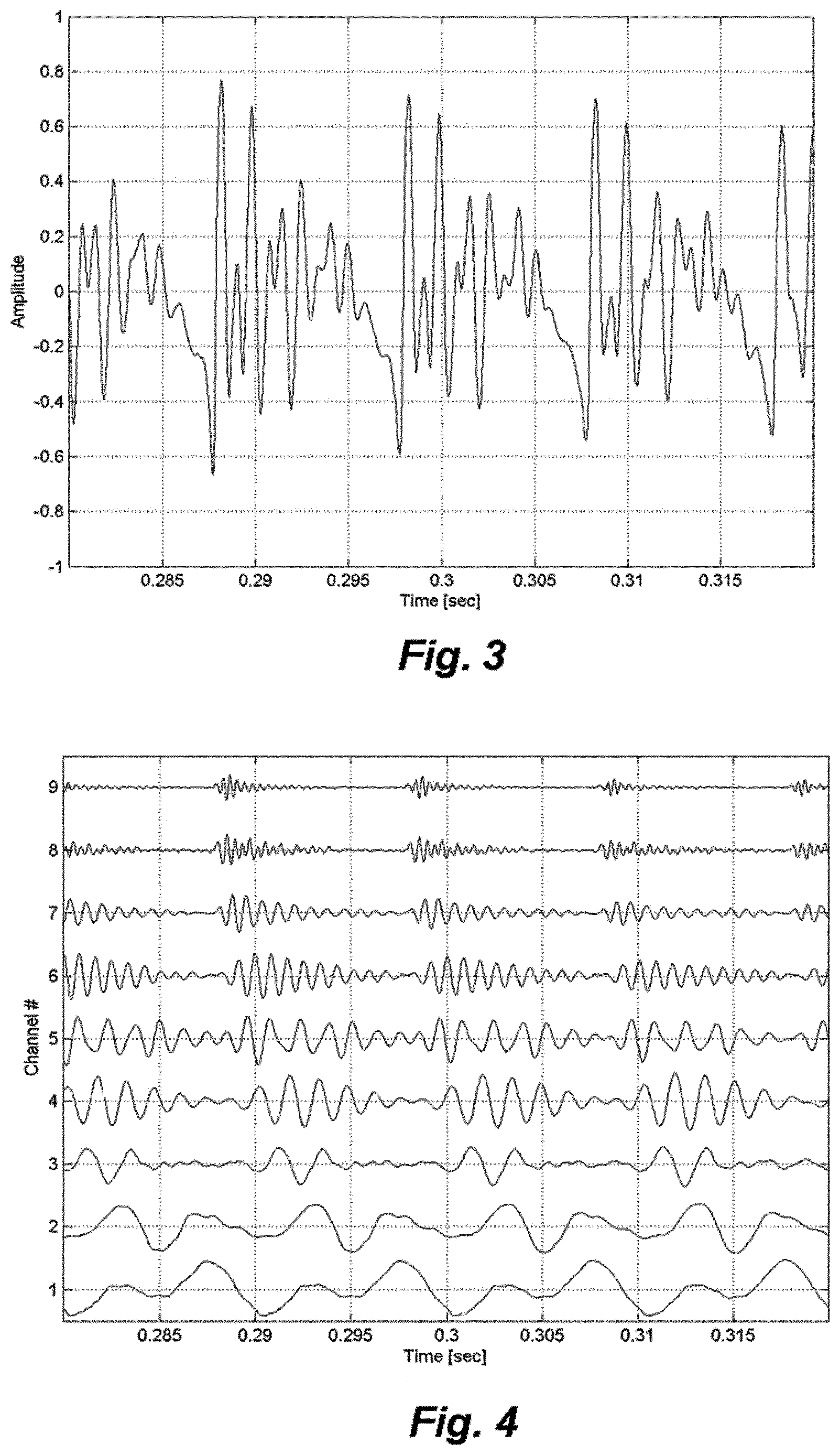 Patent US12616838 Figure 3 – Patient specific frequency mapping procedure for hearing implant electrode arrays