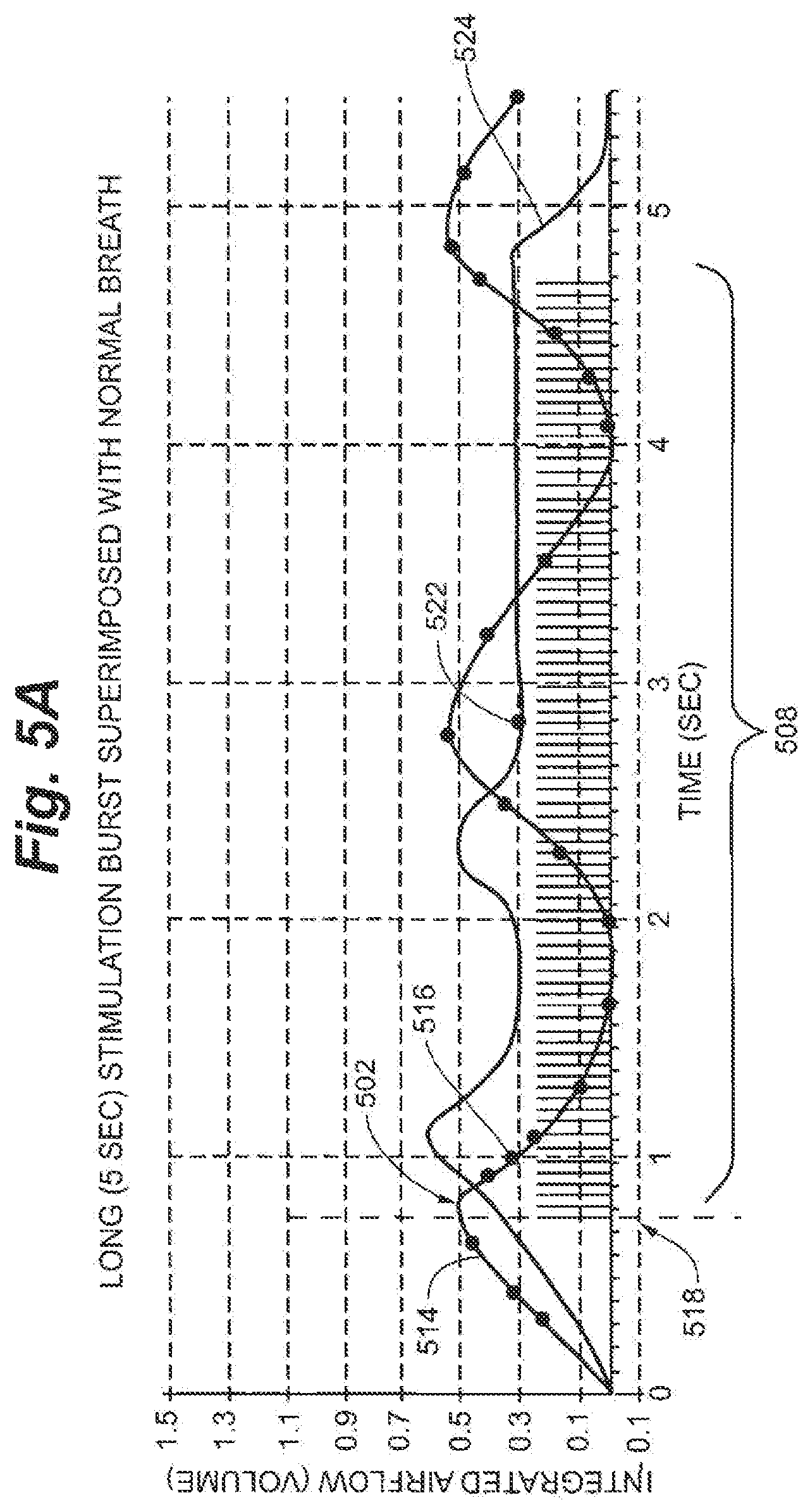 Patent US12616839 Figure 4 – System and method to modulate phrenic nerve to prevent sleep apnea