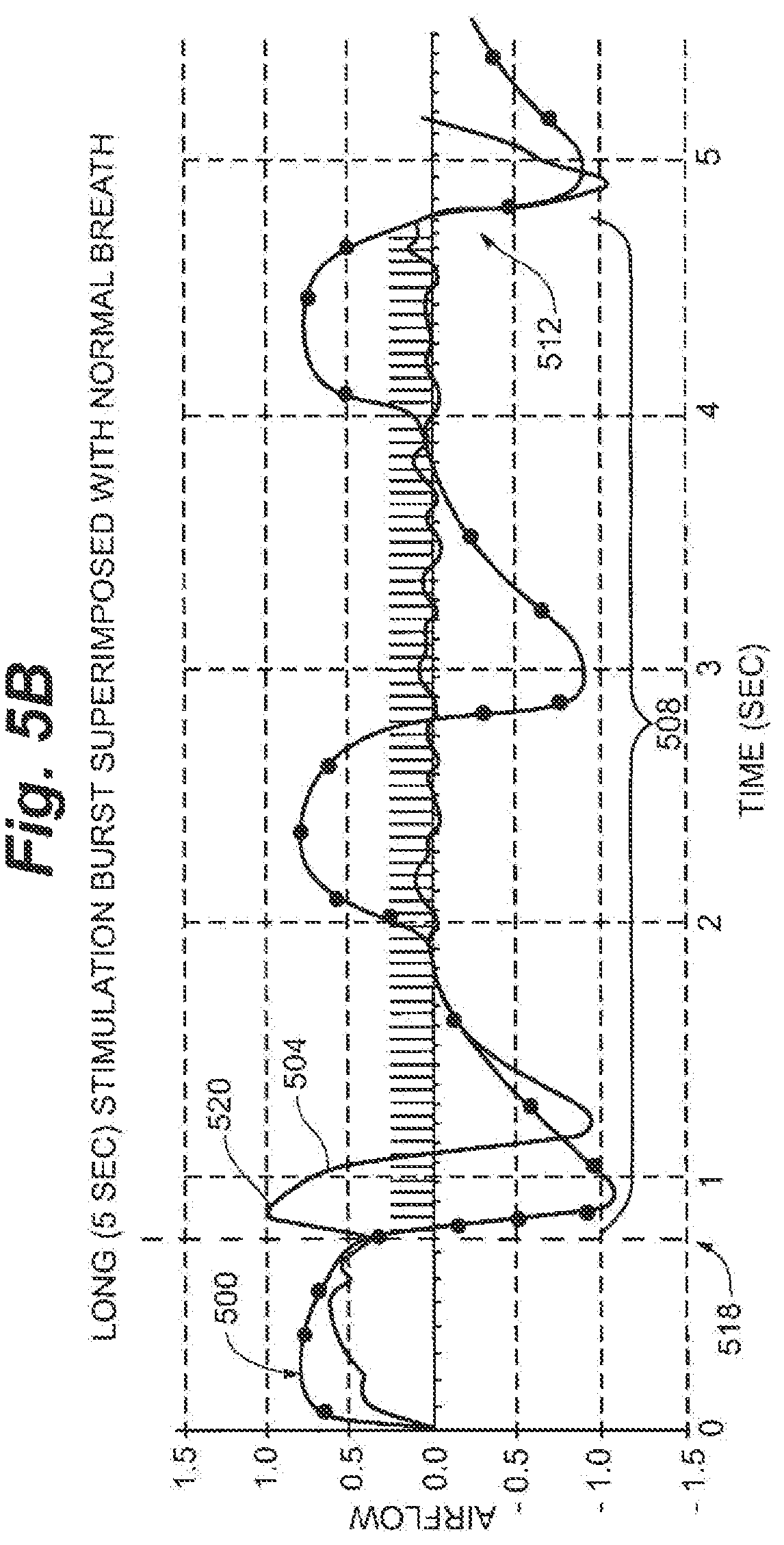 Patent US12616839 Figure 5 – System and method to modulate phrenic nerve to prevent sleep apnea