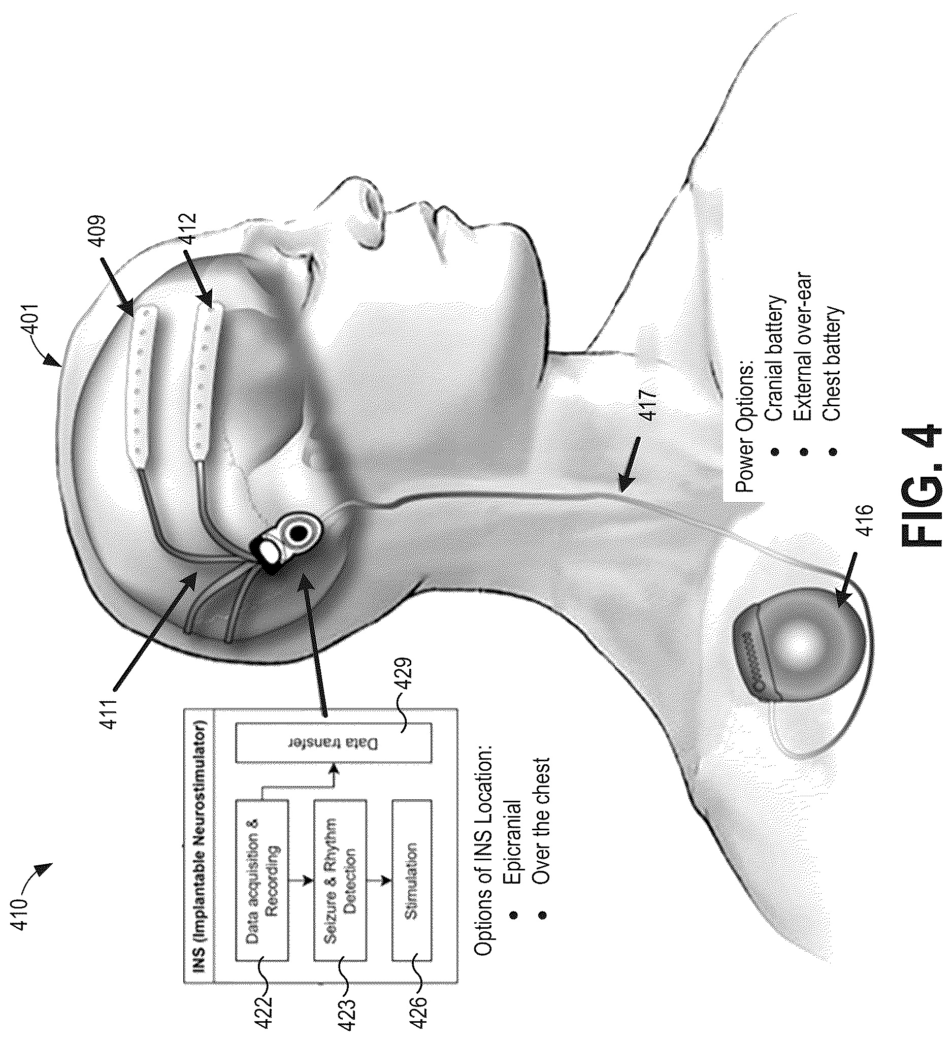 Patent US12616840 Figure 5 – Systems and methods for seizure detection and closed-loop neurostimulation