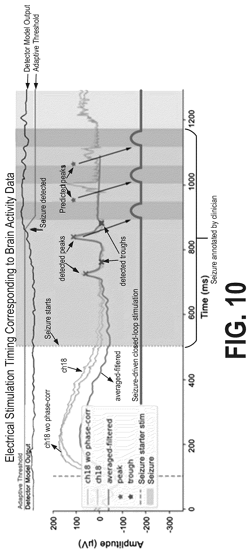 Patent US12616840 Figure 11 – Systems and methods for seizure detection and closed-loop neurostimulation