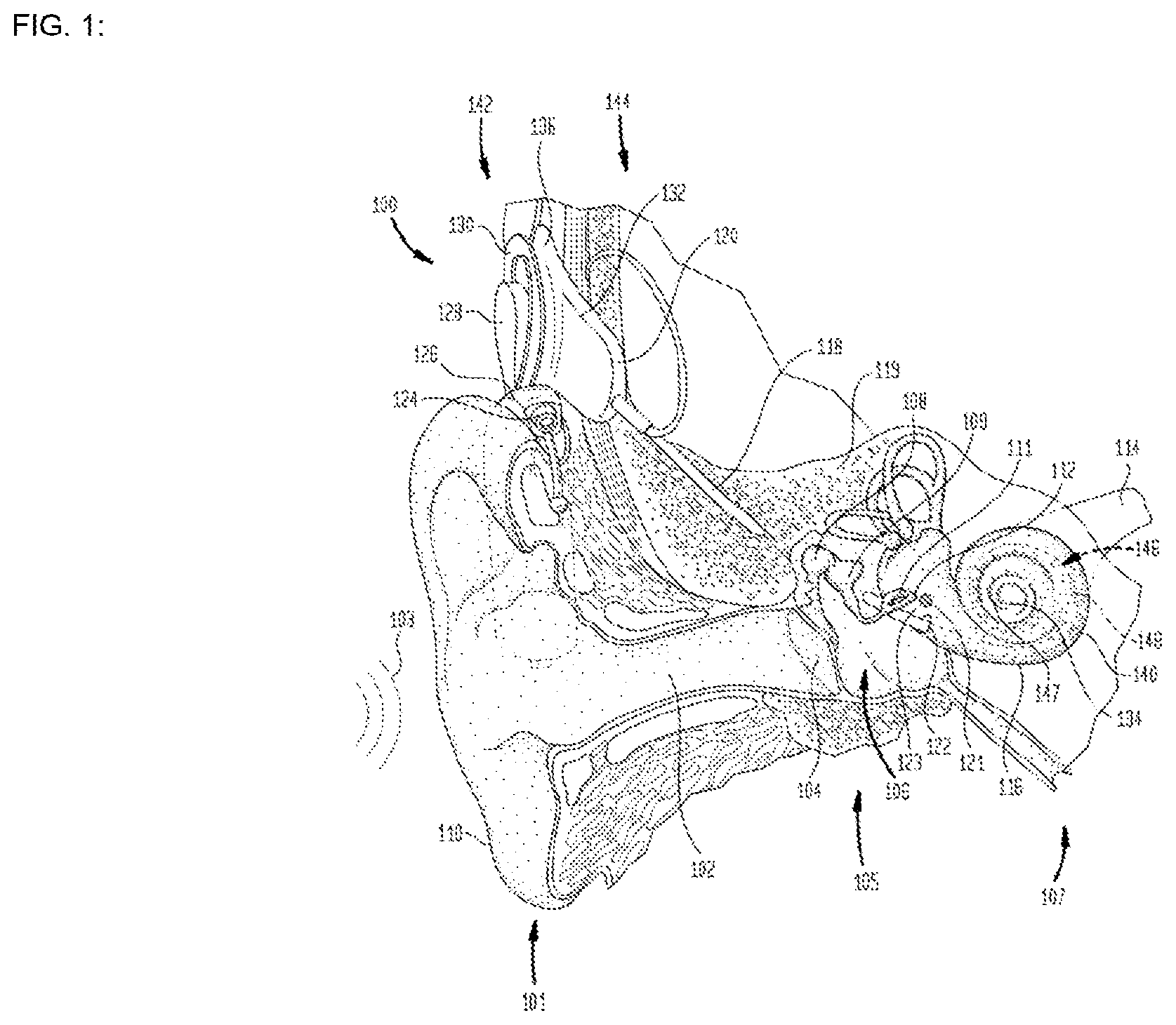 Patent US12616842 Figure 1 – Self-locking fixation system for medical implant