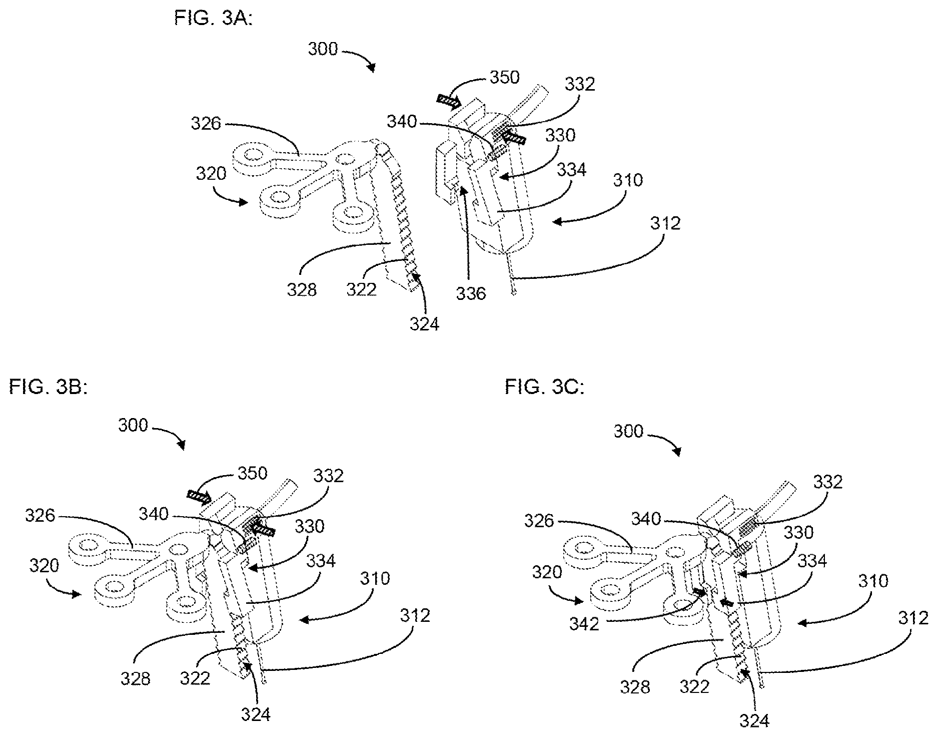 Patent US12616842 Figure 3 – Self-locking fixation system for medical implant