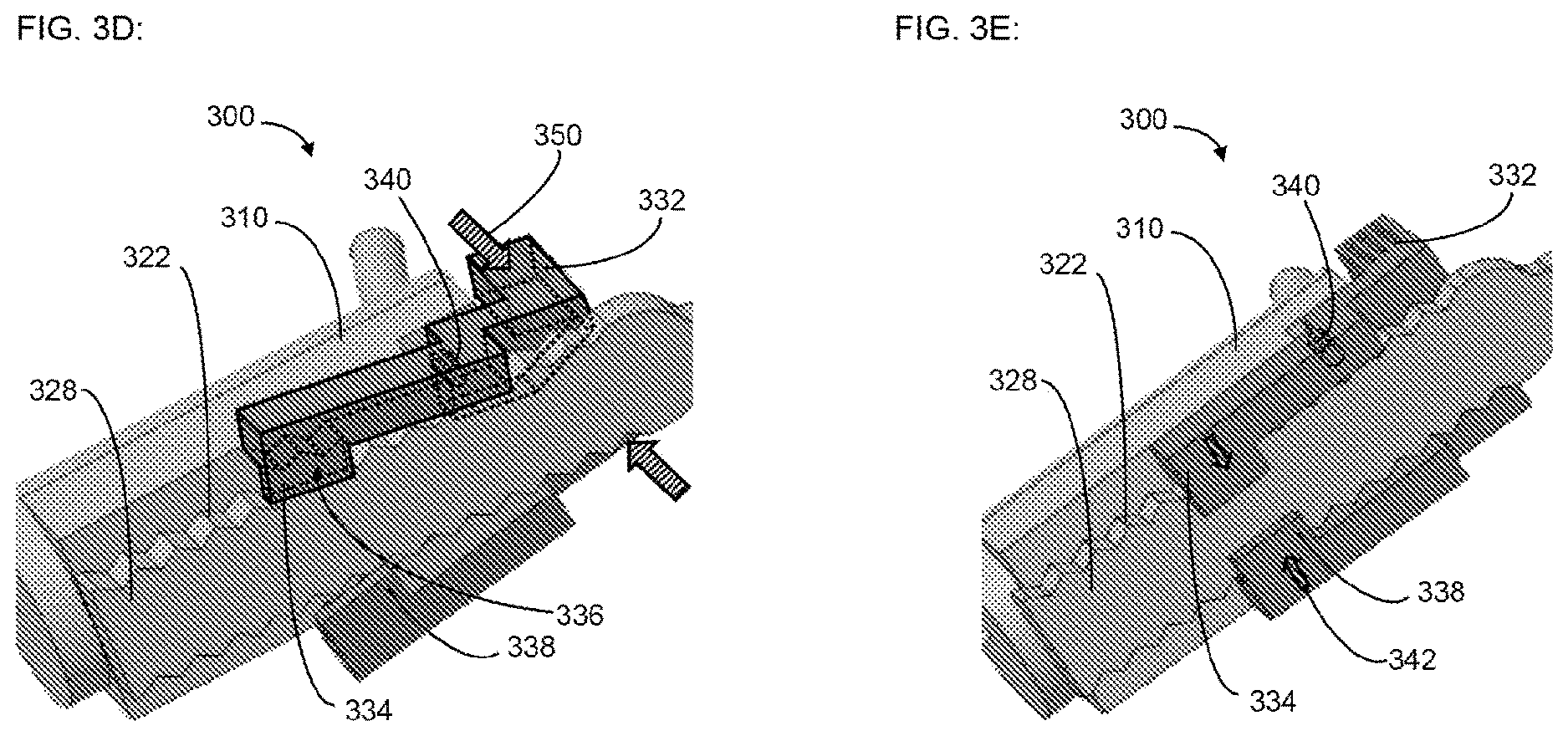 Patent US12616842 Figure 4 – Self-locking fixation system for medical implant