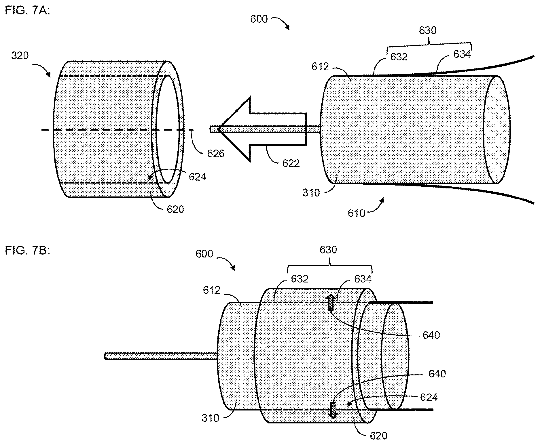 Patent US12616842 Figure 9 – Self-locking fixation system for medical implant