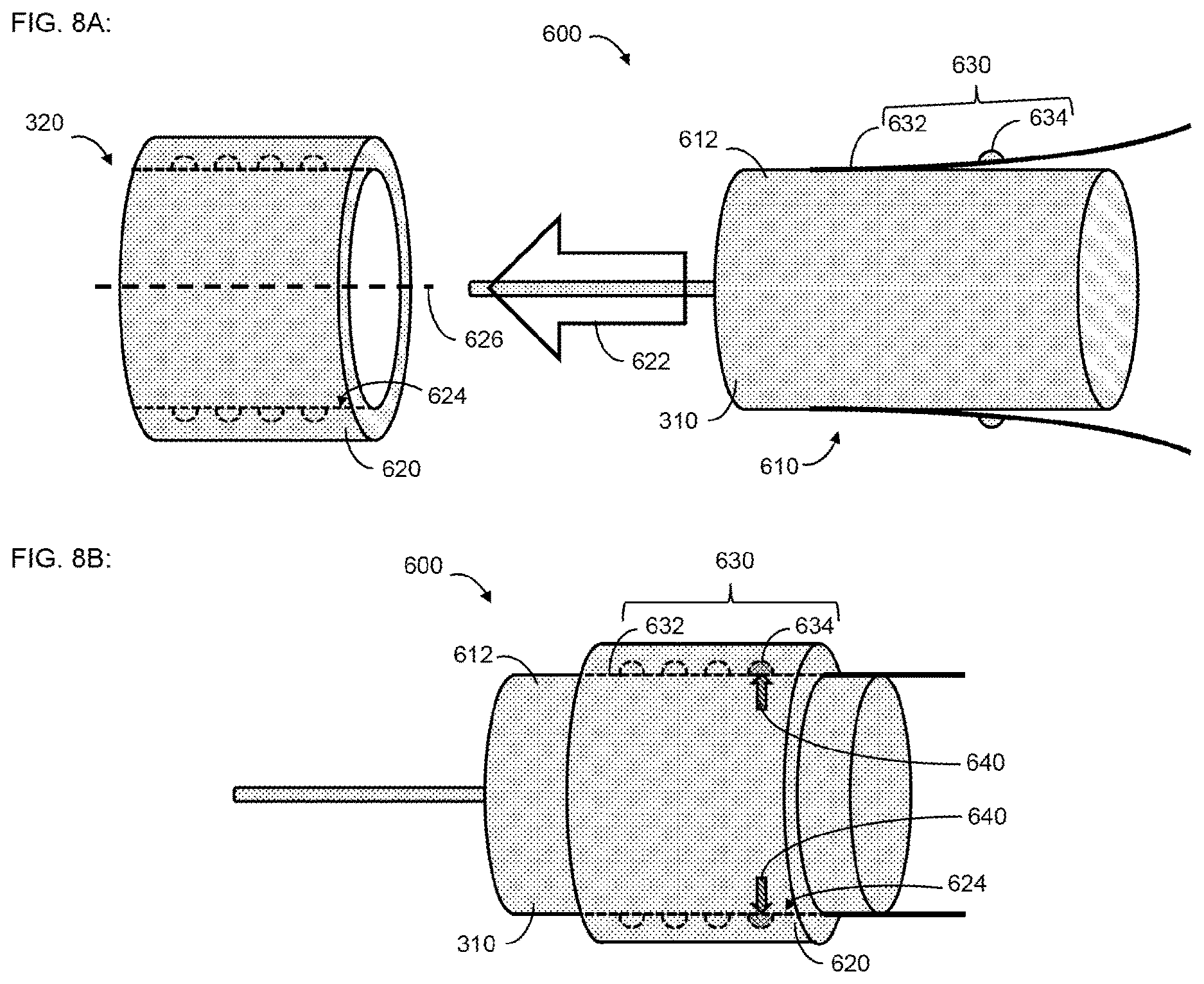 Patent US12616842 Figure 10 – Self-locking fixation system for medical implant