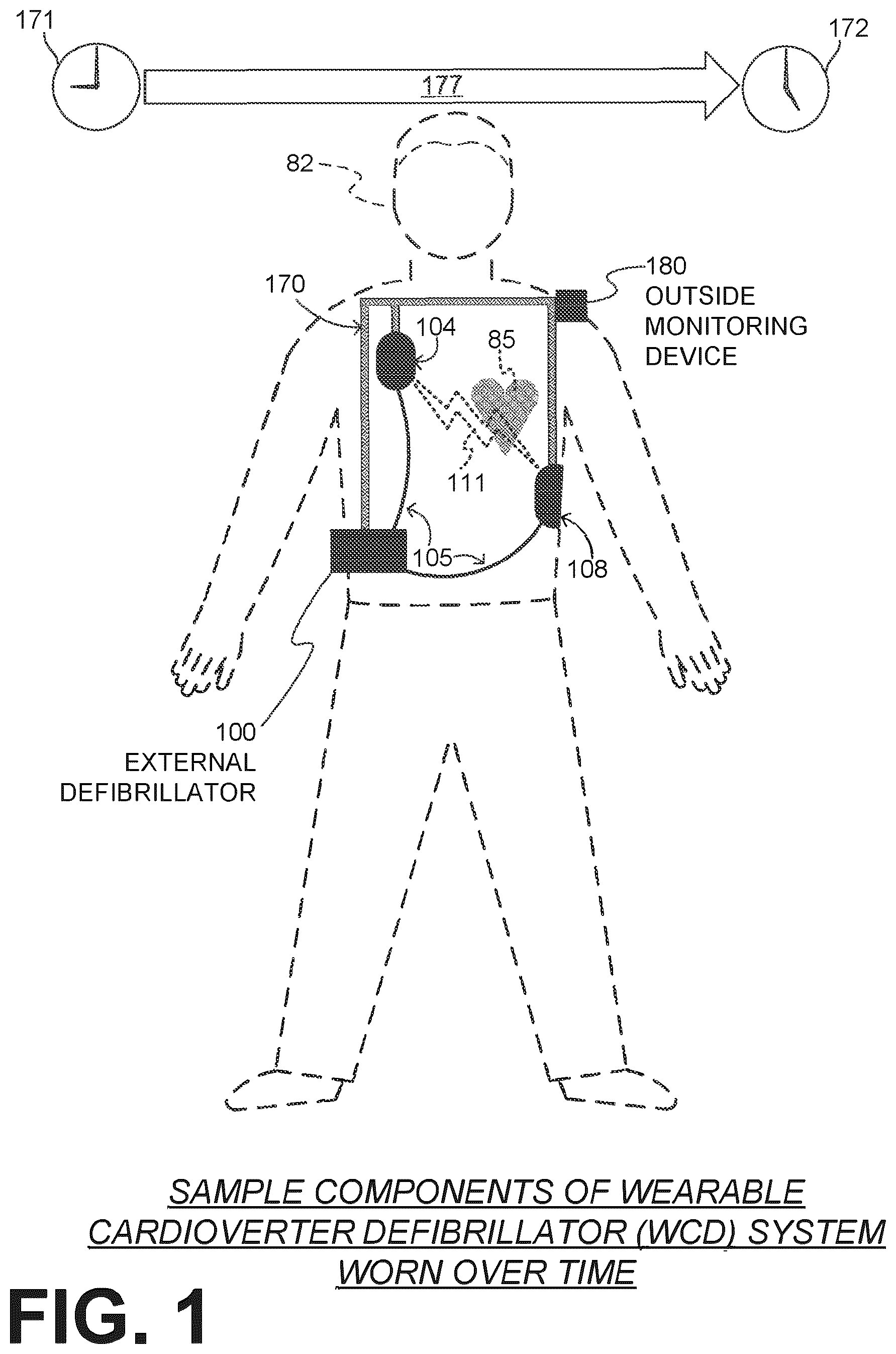 Patent US12616844 Figure 1 – Substantially-median-based determination of long-term heart rates from ECG data of wearable cardioverter defibrillator (WCD) system