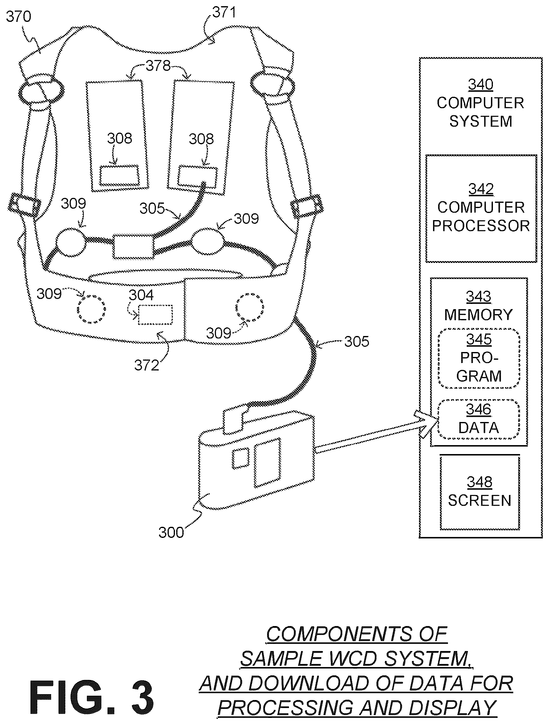 Patent US12616844 Figure 3 – Substantially-median-based determination of long-term heart rates from ECG data of wearable cardioverter defibrillator (WCD) system