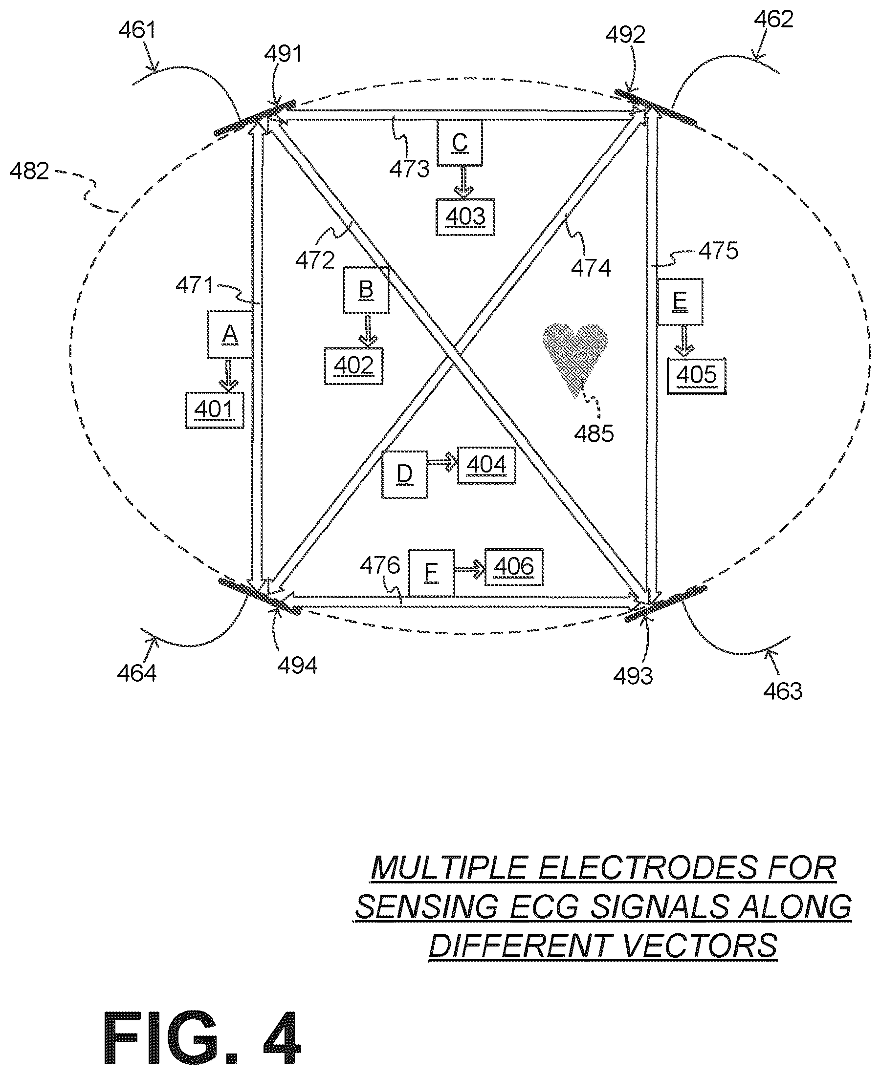 Patent US12616844 Figure 4 – Substantially-median-based determination of long-term heart rates from ECG data of wearable cardioverter defibrillator (WCD) system