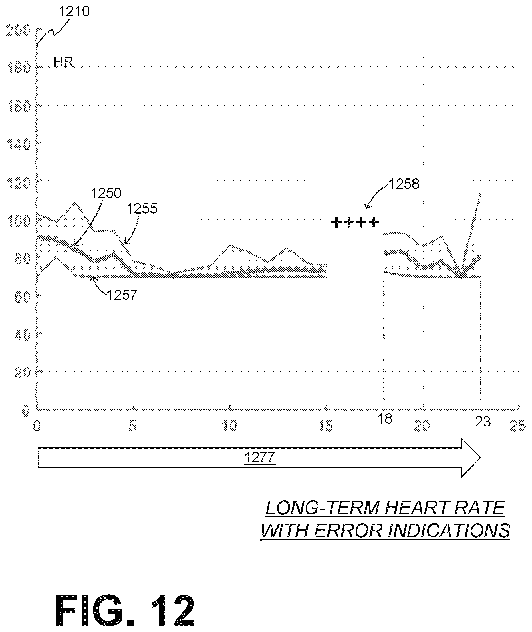 Patent US12616844 Figure 14 – Substantially-median-based determination of long-term heart rates from ECG data of wearable cardioverter defibrillator (WCD) system