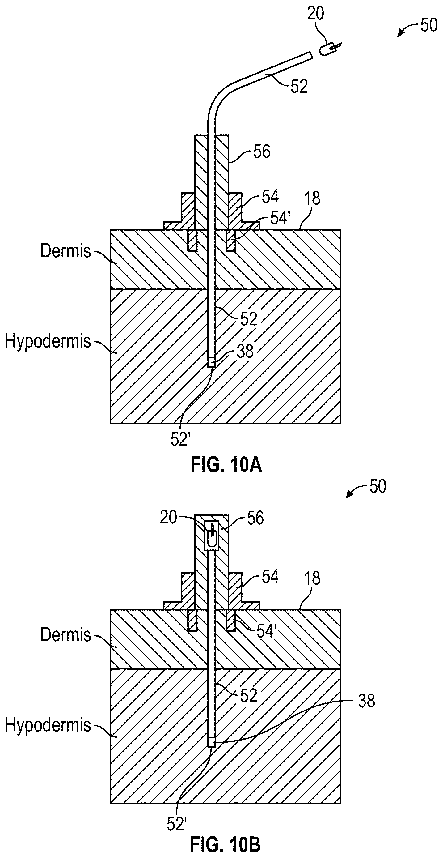 Patent US12616845 Figure 10 – Devices and related methods for light-based modulation of foreign body responses in living tissue