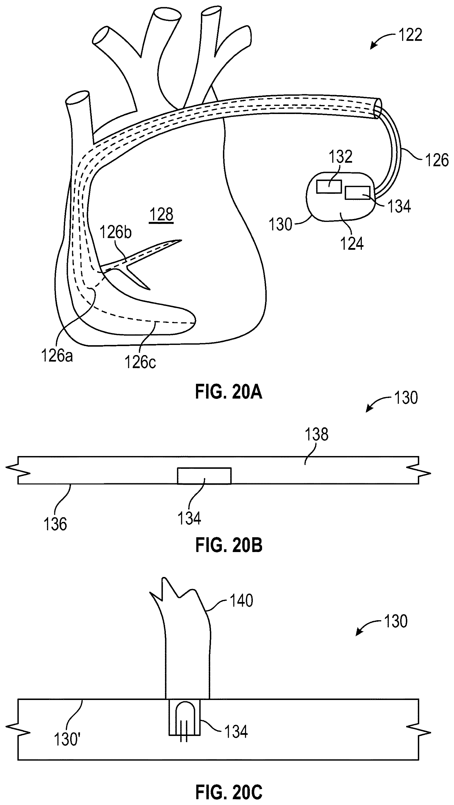 Patent US12616845 Figure 18 – Devices and related methods for light-based modulation of foreign body responses in living tissue