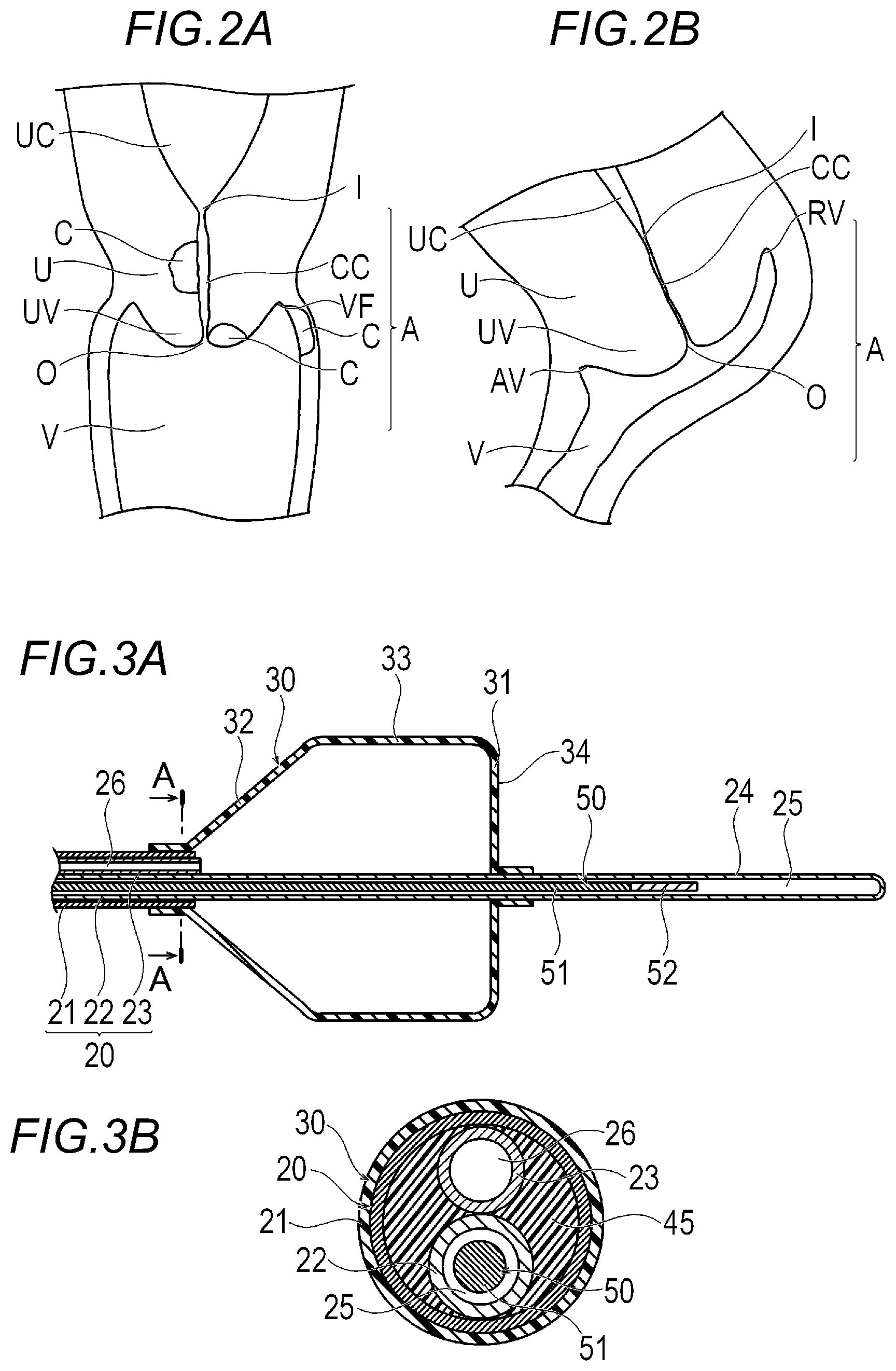 Patent US12616846 Figure 2 – Treatment apparatus and treatment method