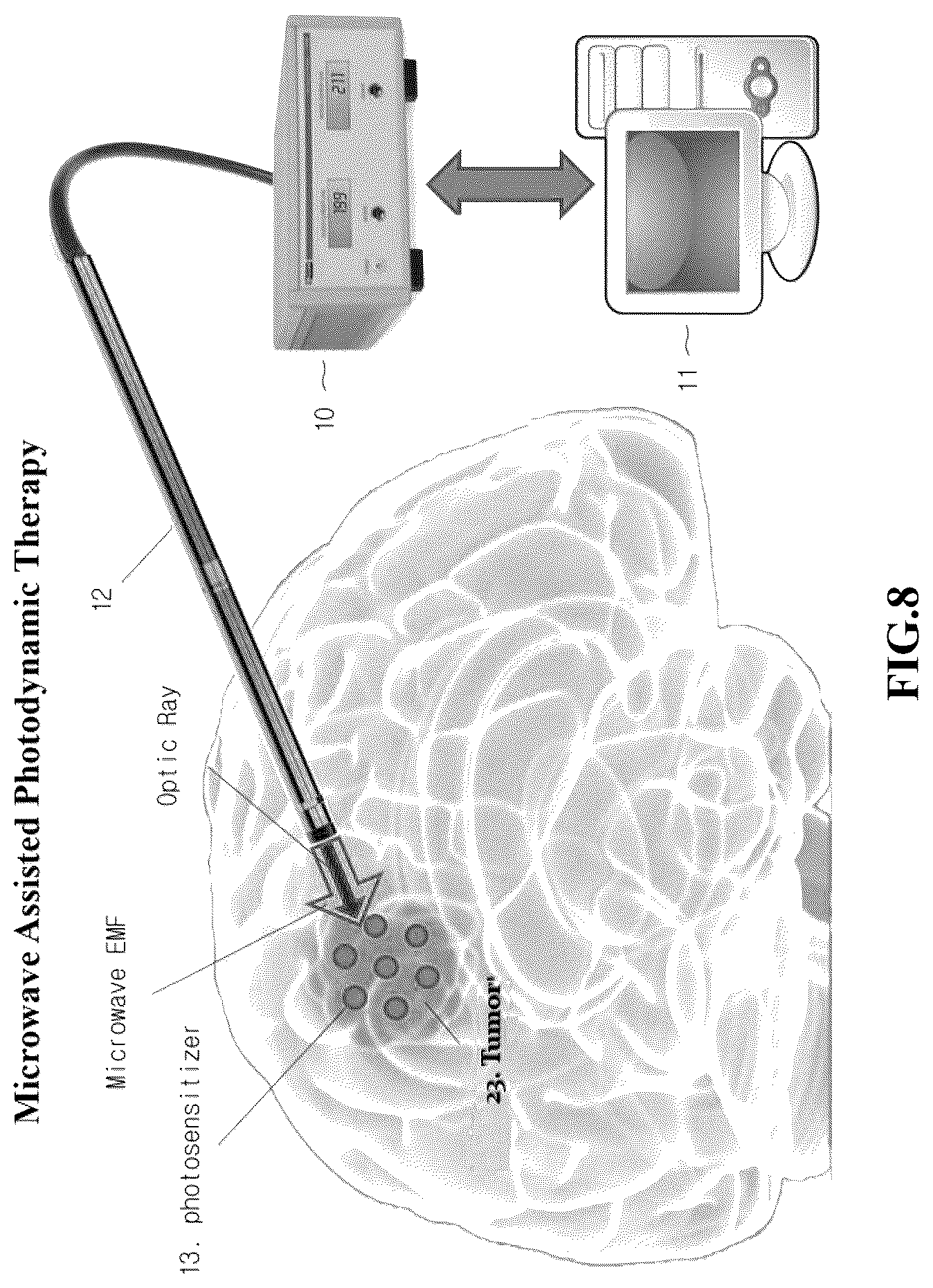 Patent US12616847 Figure 8 – Photodynamic therapy and microwave therapy fusion system