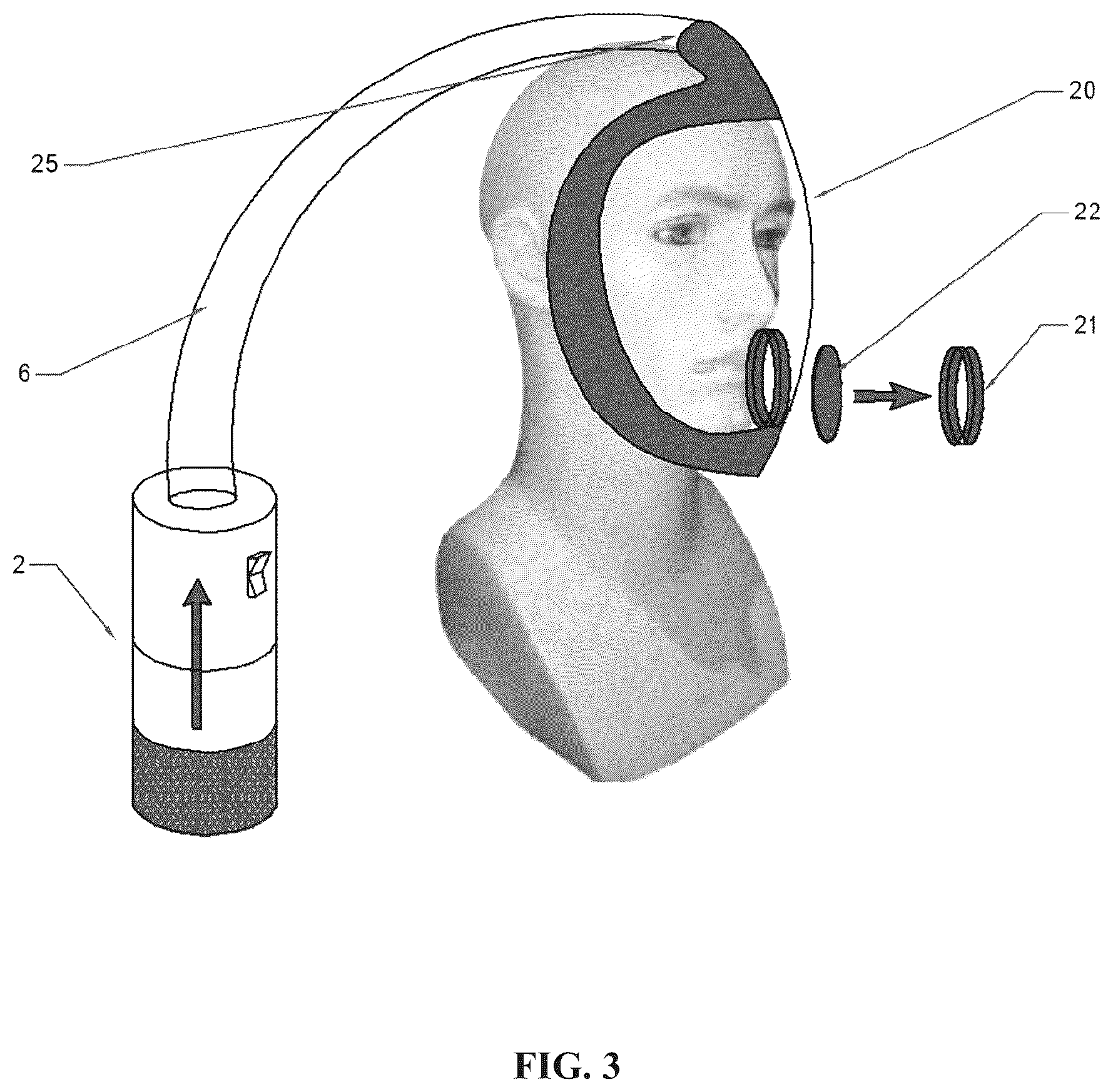 Patent US12616855 Figure 3 – Device for personal protection and insulation against pollutants and microorganisms and filtering group for devices for protection and insulation