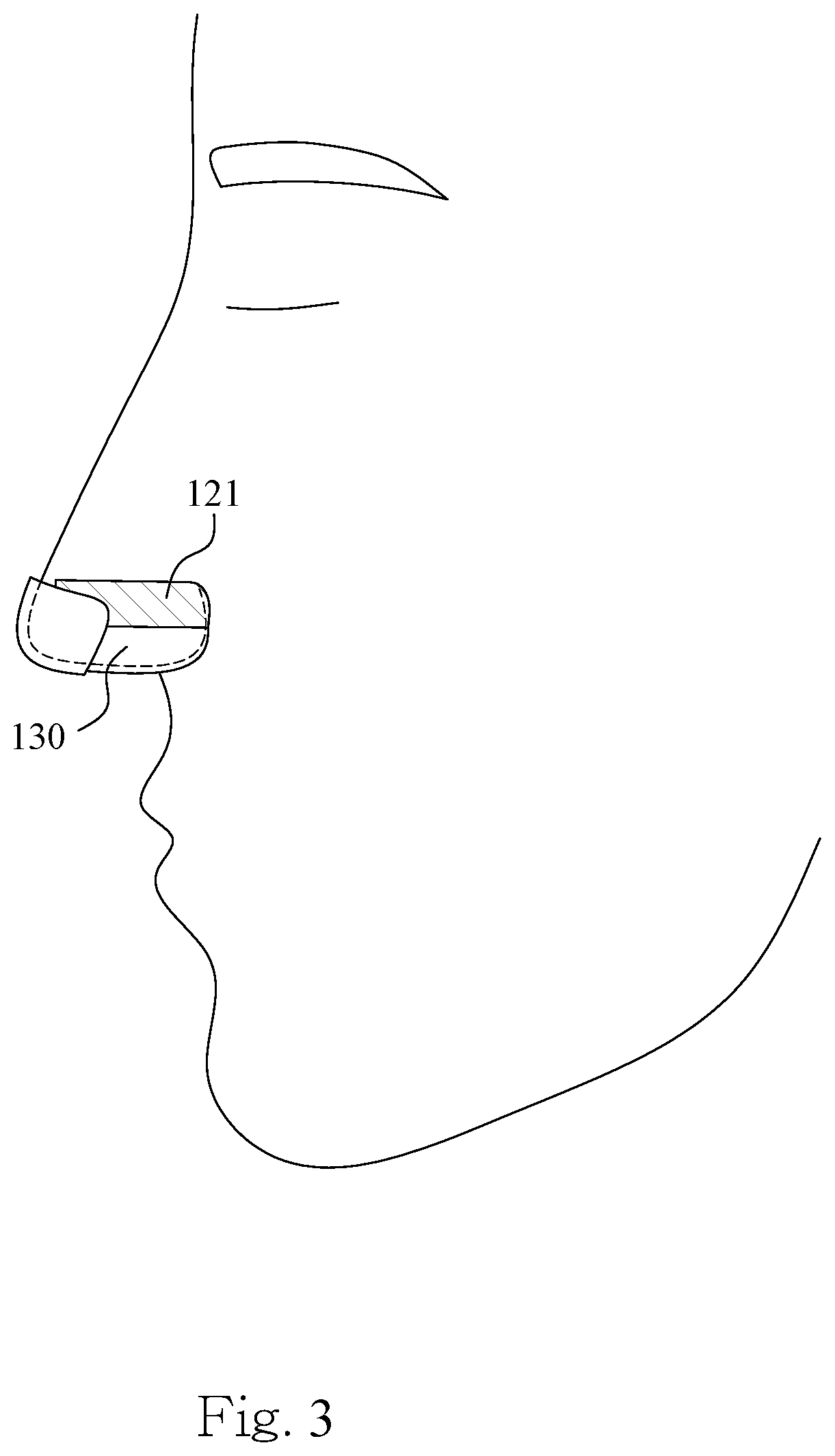 Patent US12616858 Figure 3 – Nasal mask