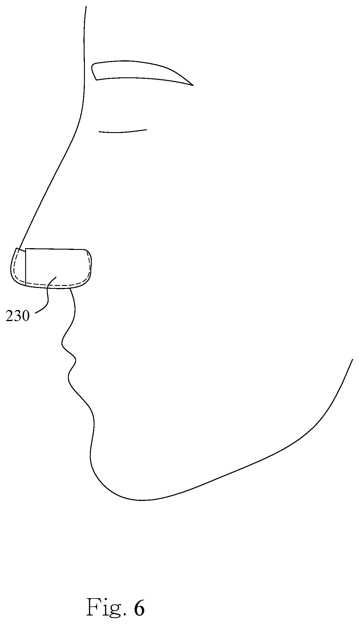 Patent US12616858 Figure 6 – Nasal mask