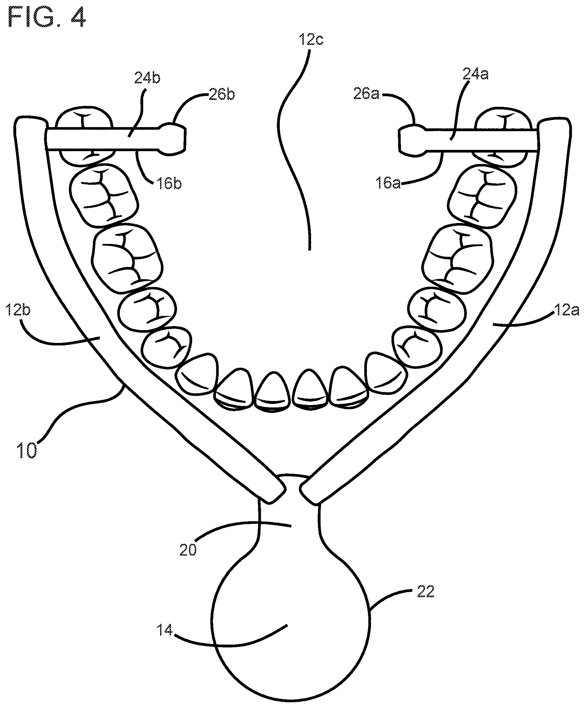 Patent US12616873 Figure 4 – Mandibular advancement device