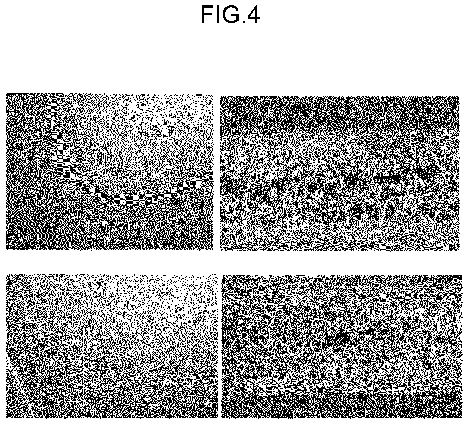 Patent US12617132 Figure 5 – Foam-molded product, method for manufacturing foam-molded product, and method for suppressing appearance defect of foam-molded product