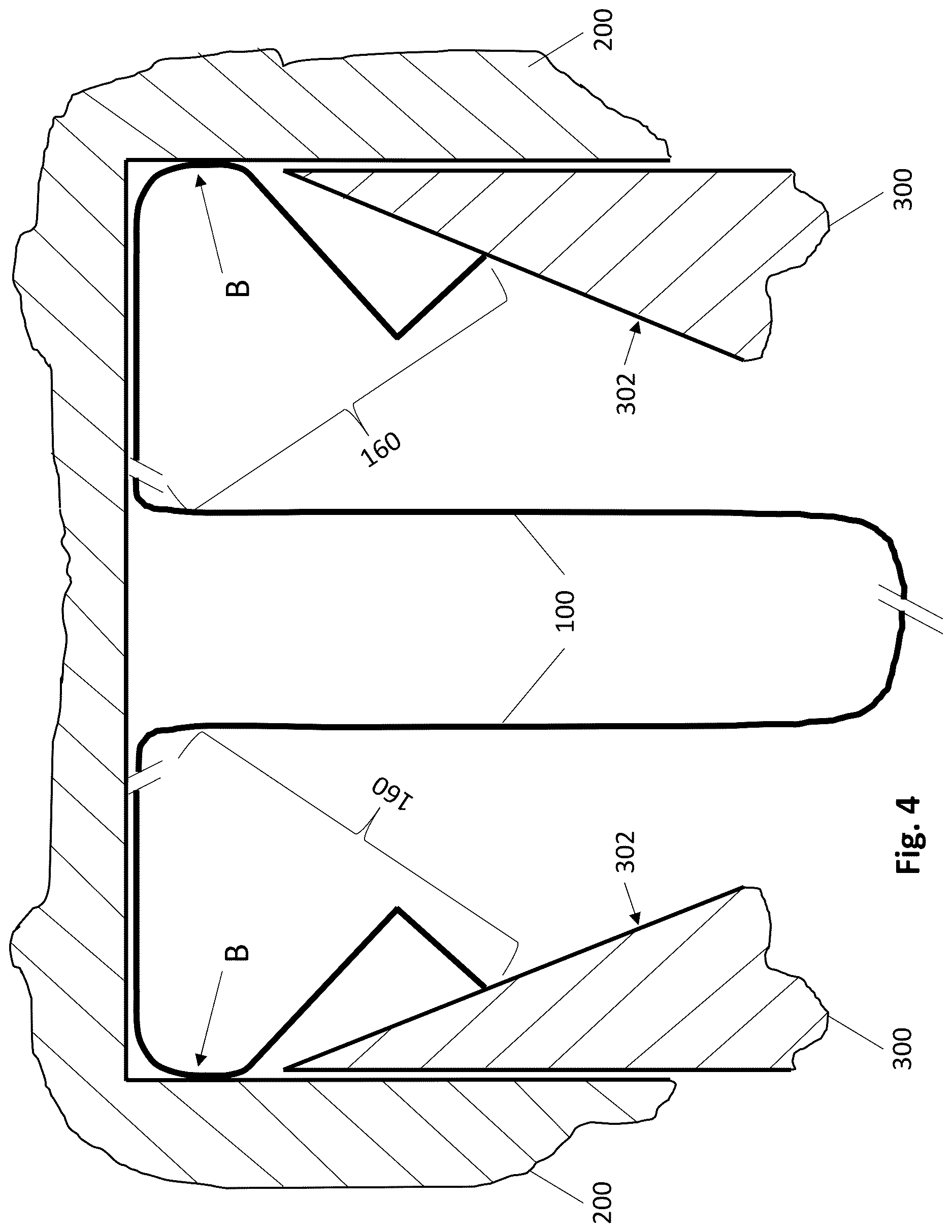 Patent US12617142 Figure 7 – Rolled edge trays having smooth edges and stacking extensions