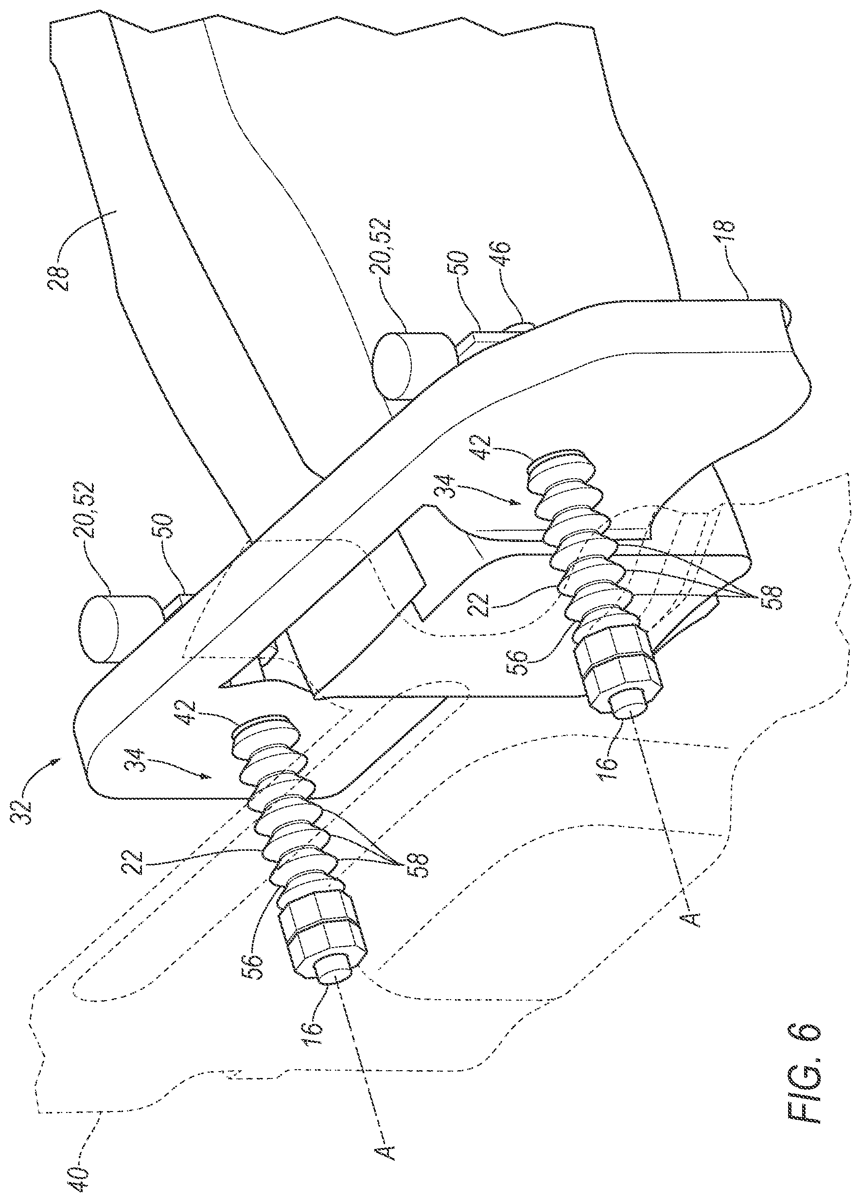 Patent US12617360 Figure 6 – Retractable bumper assembly with actuator based on vehicle speed